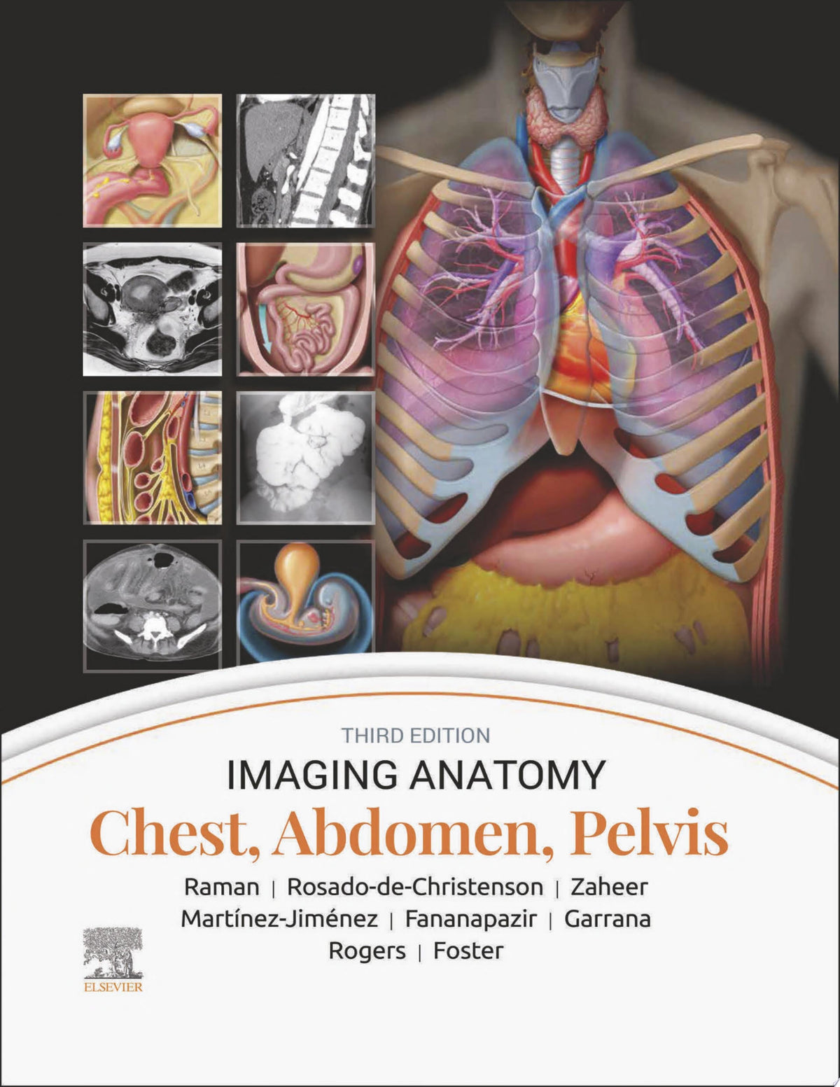 Imaging Anatomy: Chest, Abdomen, Pelvis, 3rd Edition