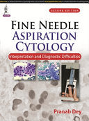 Fine Needle Aspiration Cytology: Interpretation and Diagnostic Difficulties, 2nd Edition
