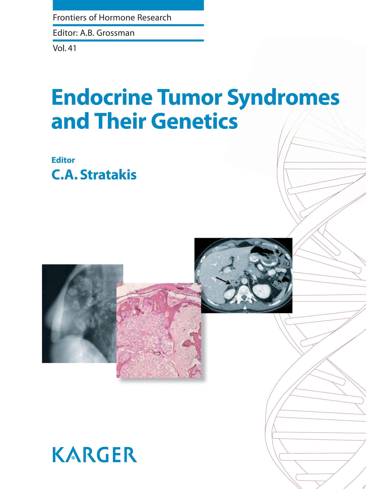 Endocrine Tumor Syndromes and Their Genetics