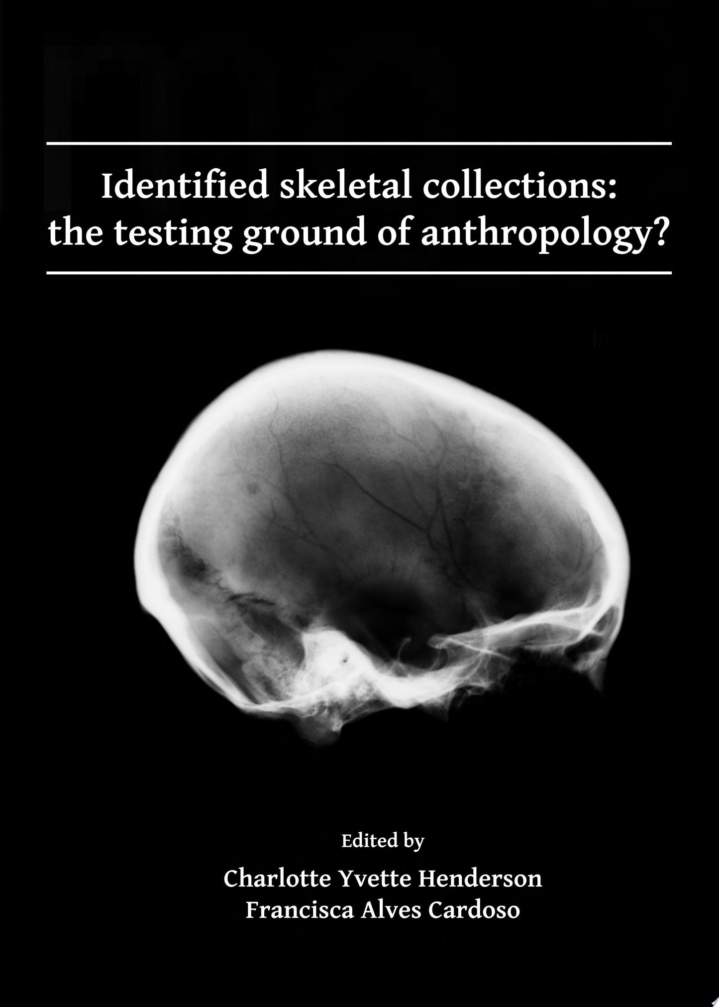 Tuberculosis and the Tubercle Bacillus, 2nd Edition