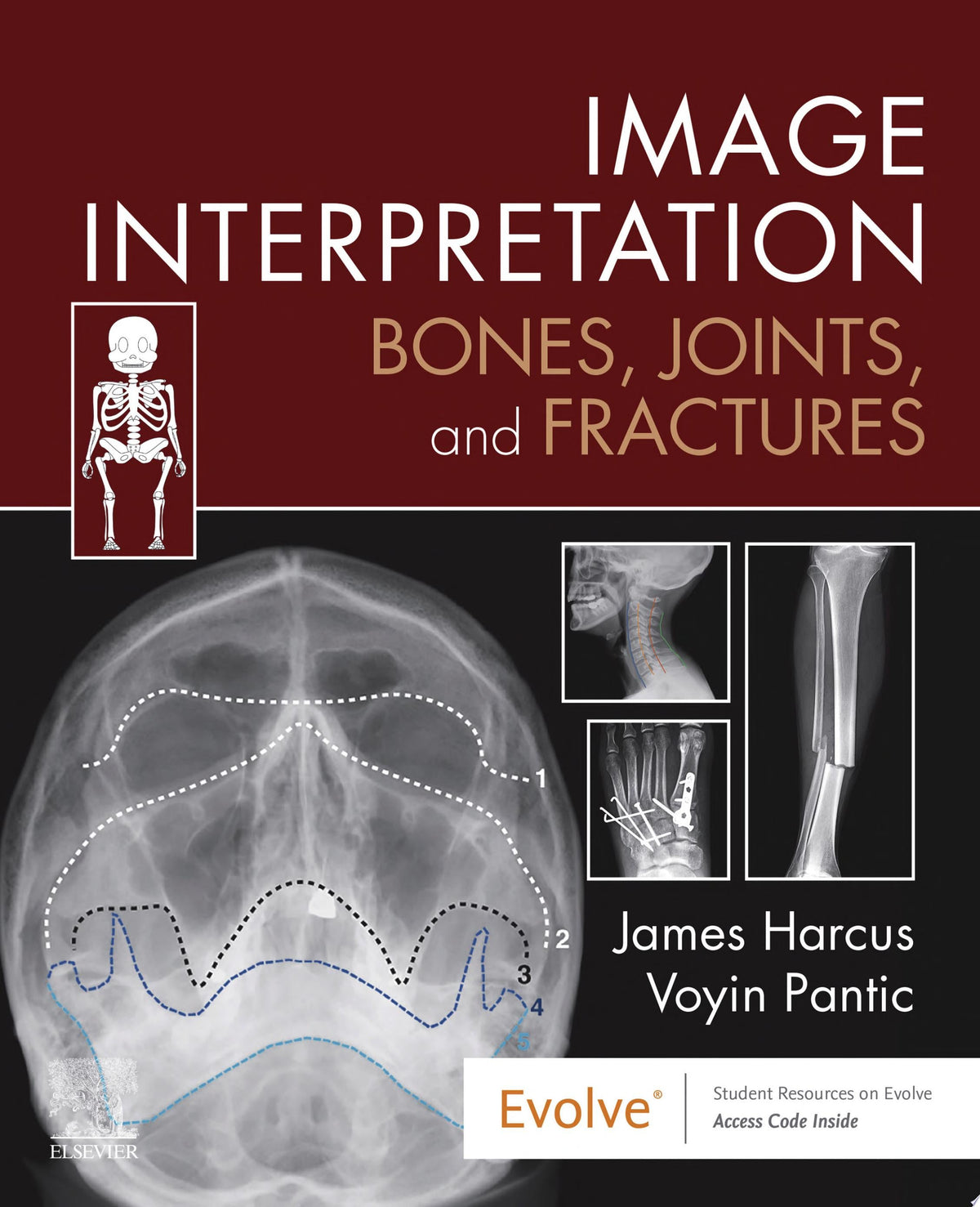 Bones and Joints: A Guide for Students, 8th edition