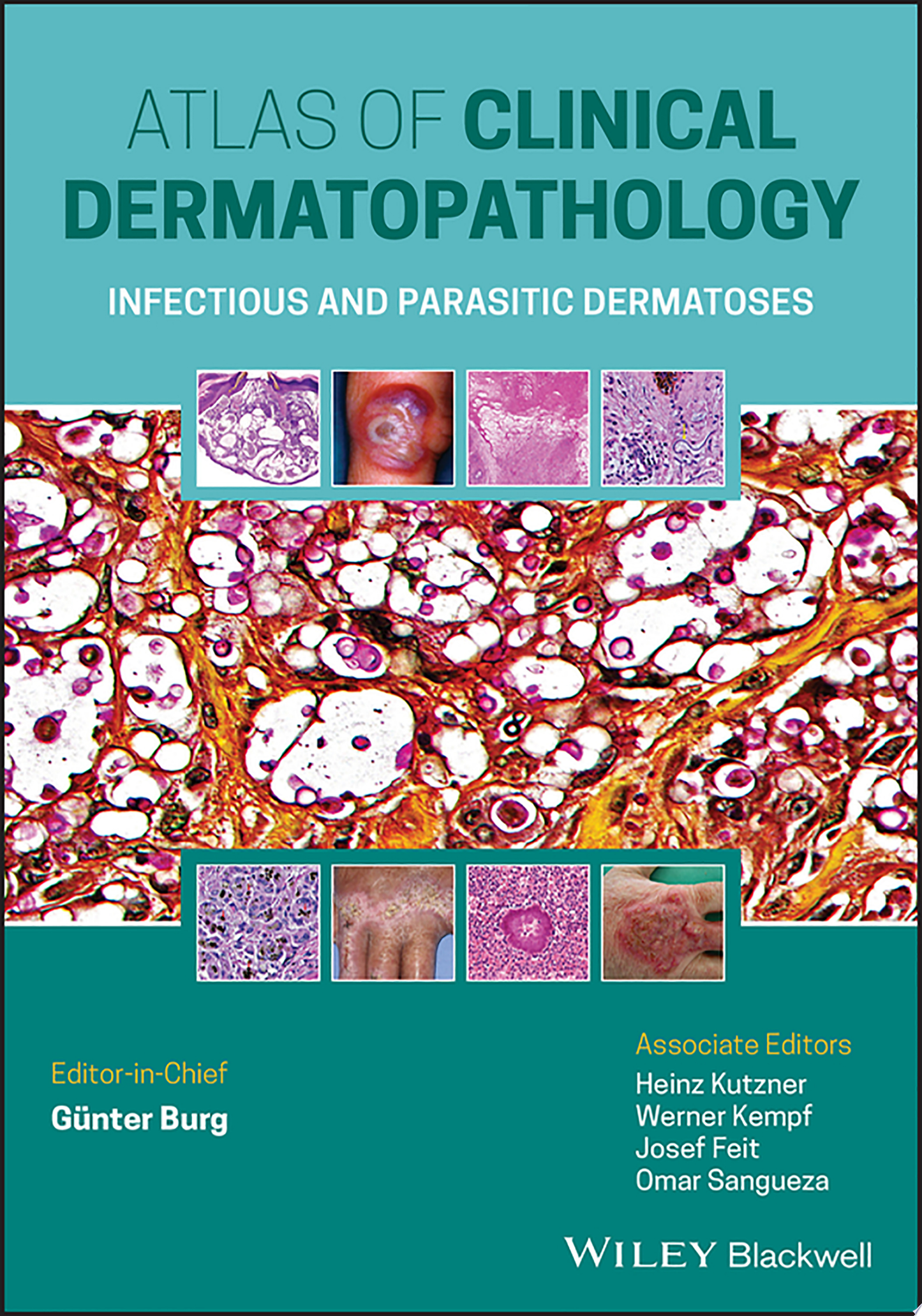 Translational Autoimmunity, Volume 2: Treatment of Autoimmune Diseases