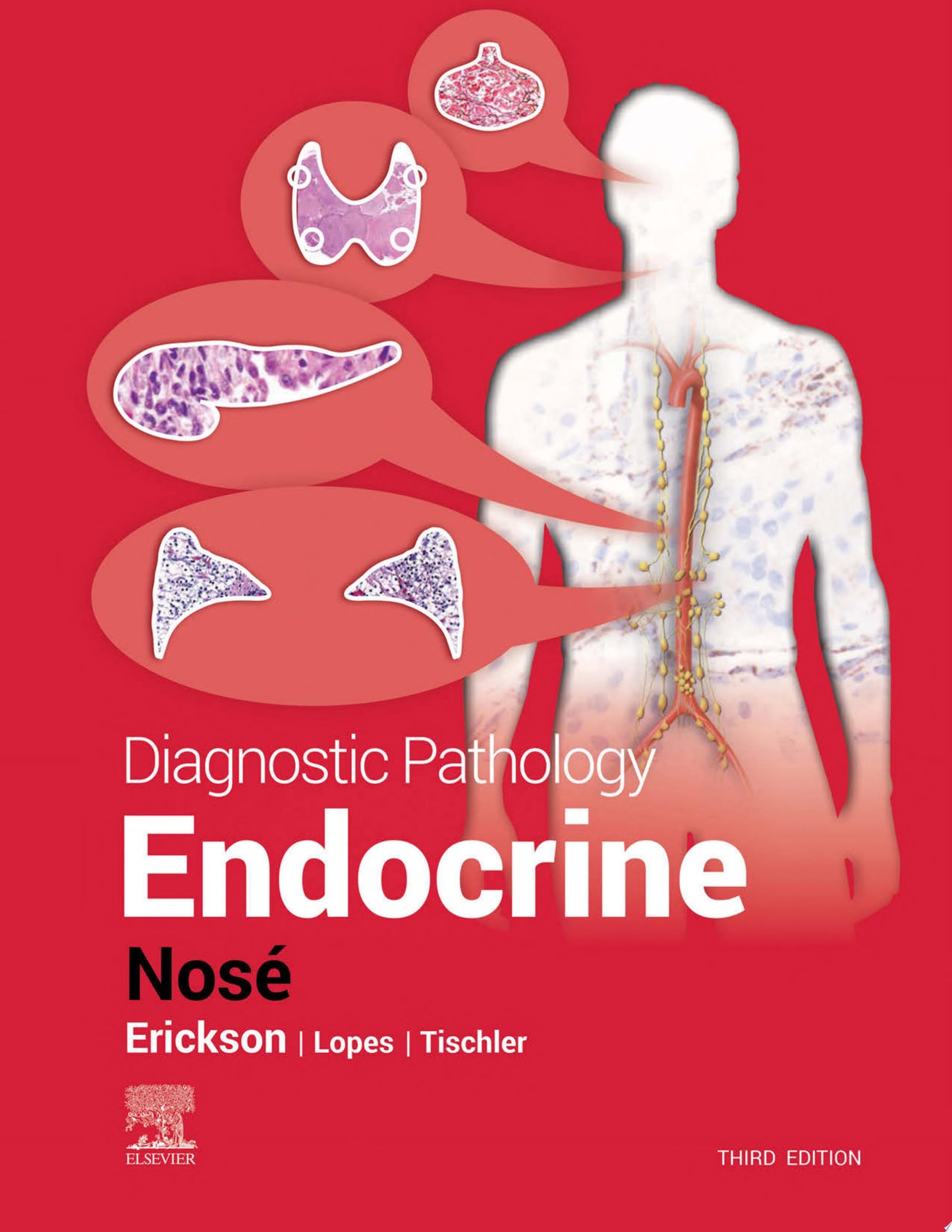 Diagnostic Pathology: Endocrine, 2nd Edition