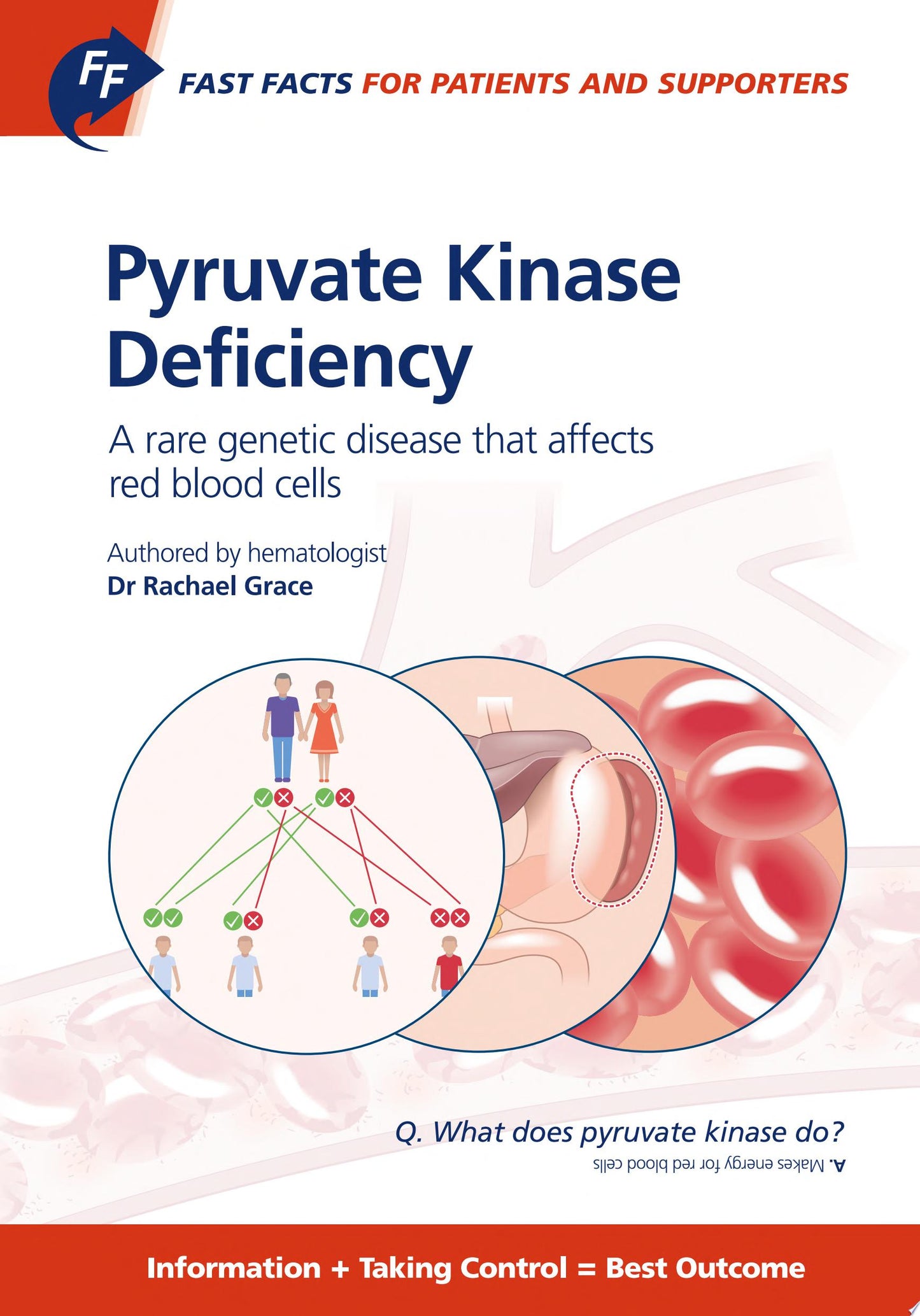 Fast Facts: Pyruvate Kinase Deficiency for Patients and Supporters; a Rare Genetic Disease That Affects Red Blood Cells