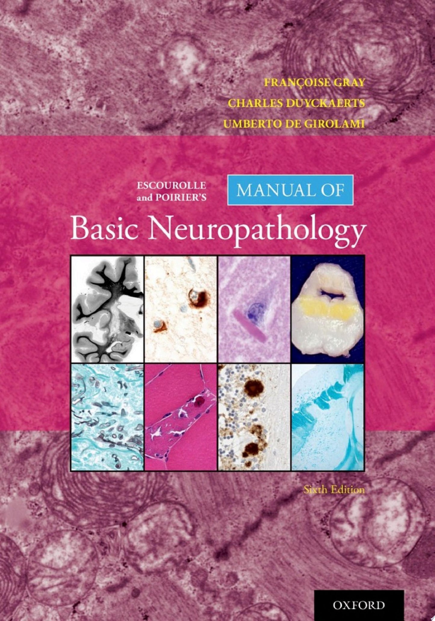 Escourolle and Poirier’s Manual of Basic Neuropathology, 6th edition