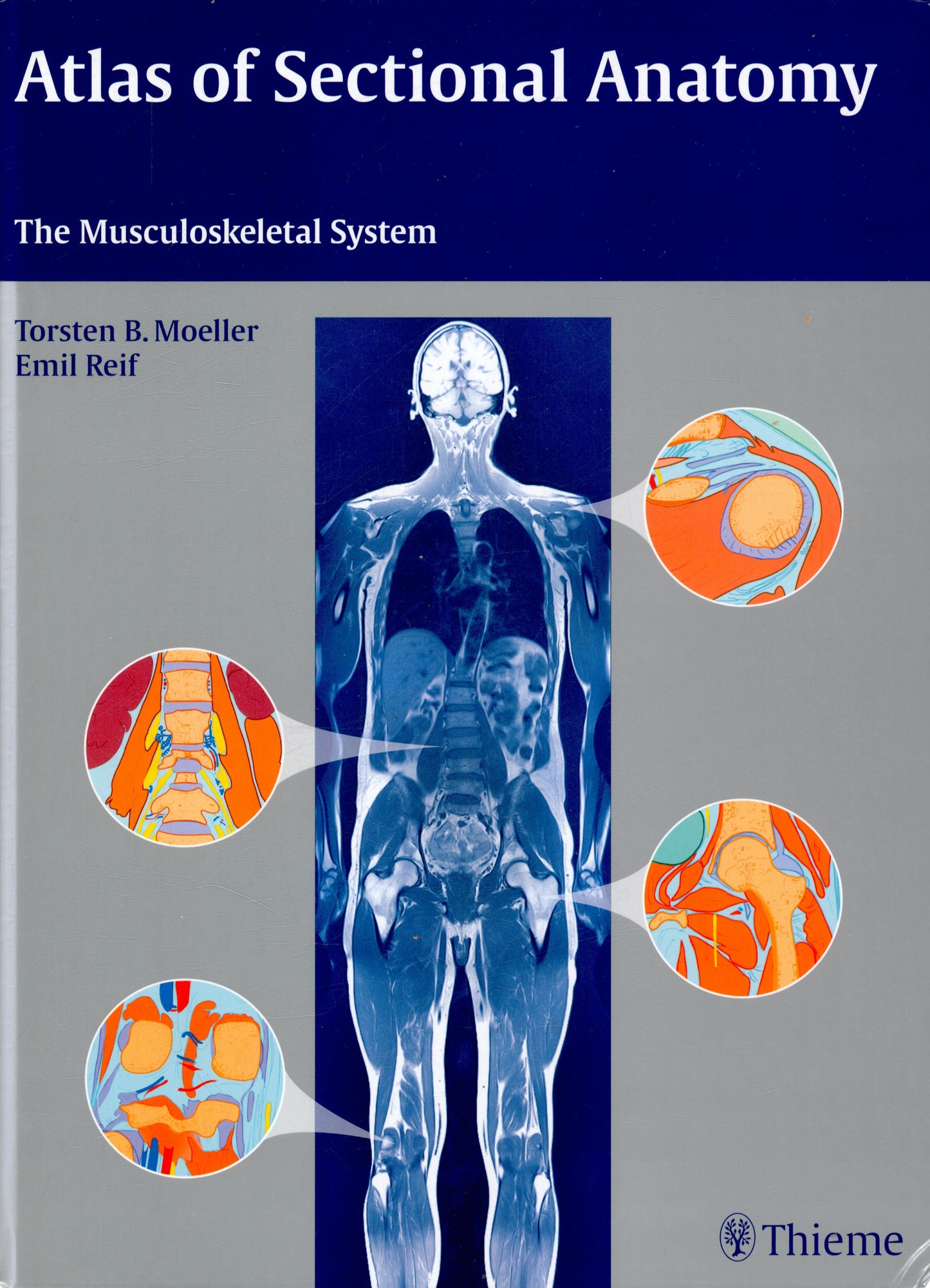 Atlas of Sectional Anatomy: The Musculoskeletal System