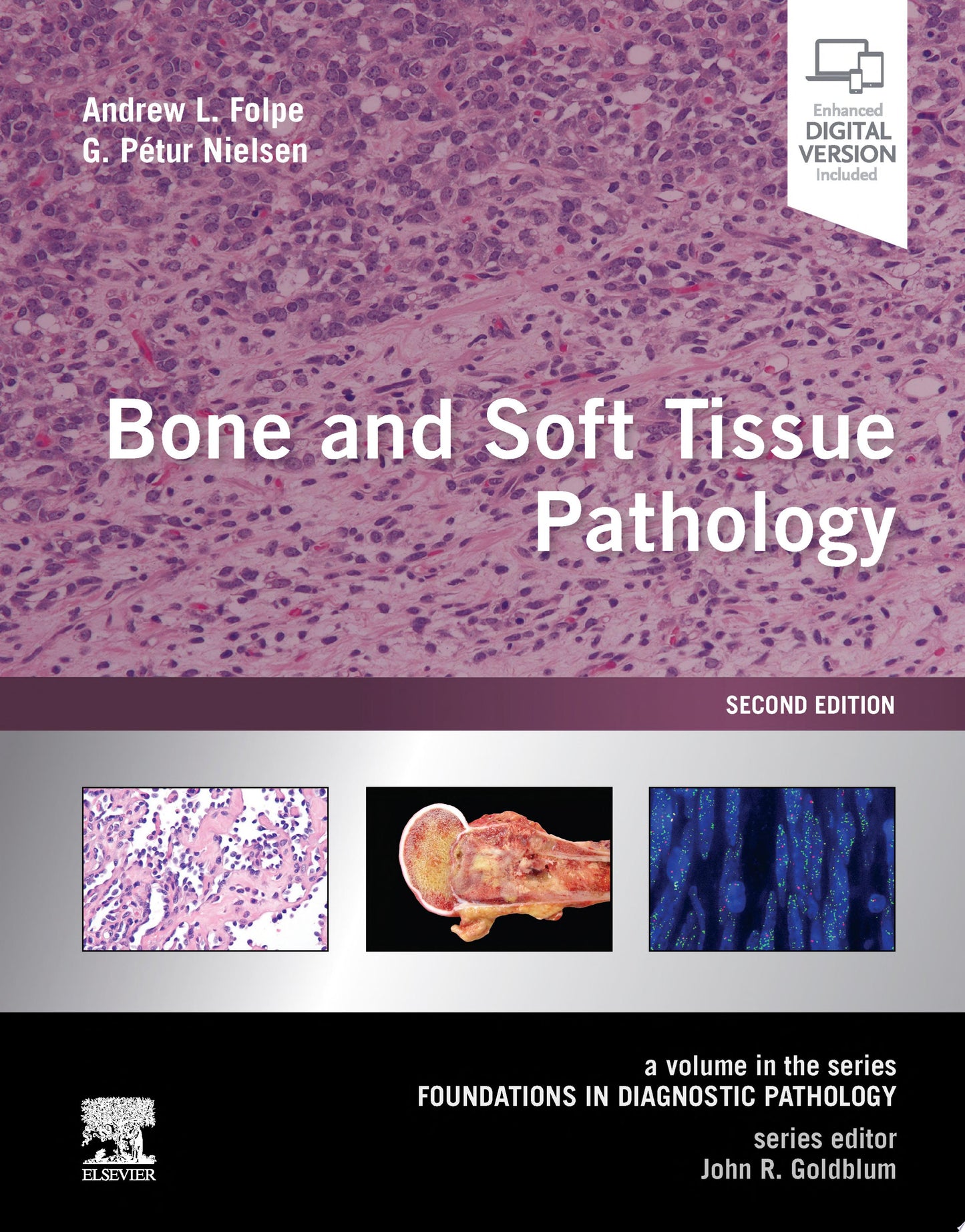 Bone and Soft Tissue Pathology: A Volume in the Foundations in Diagnostic Pathology Series