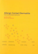 Allergic Contact Dermatitis: Chemical and Metabolic Mechanisms