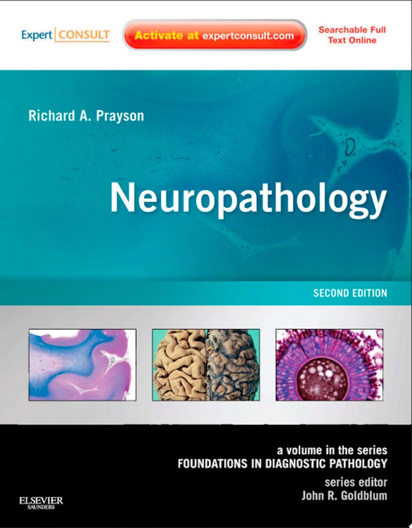Neuropathology: A Volume in the Foundations in Diagnostic Pathology Series, Expert Consult – Online and Print, 2nd