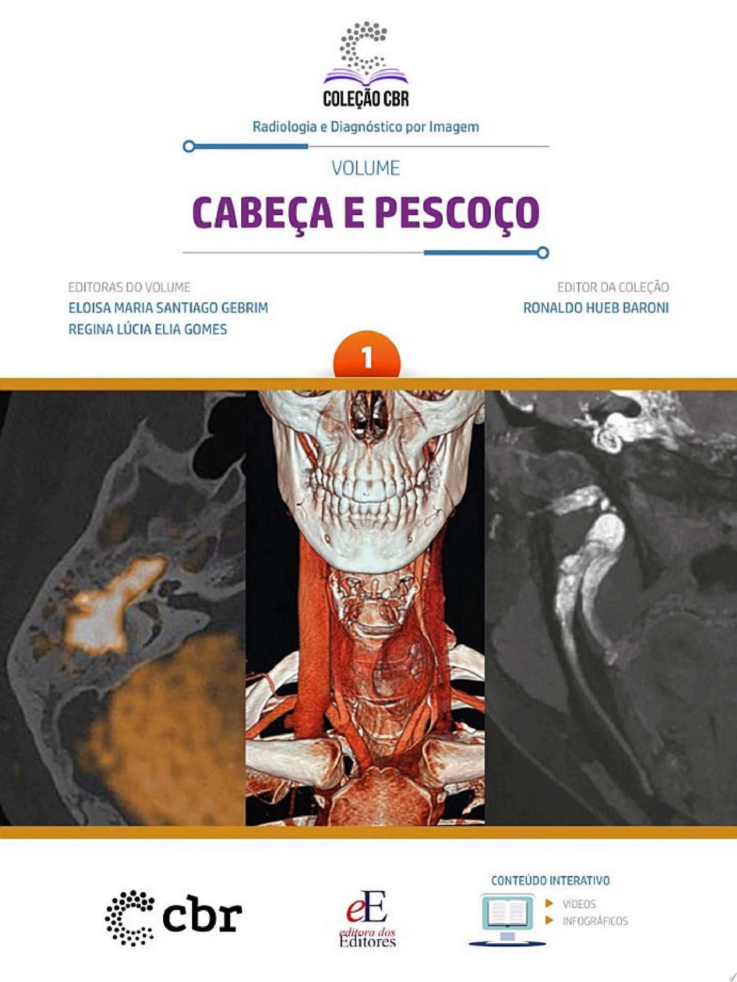 Anatomia Seccional por RM e TC