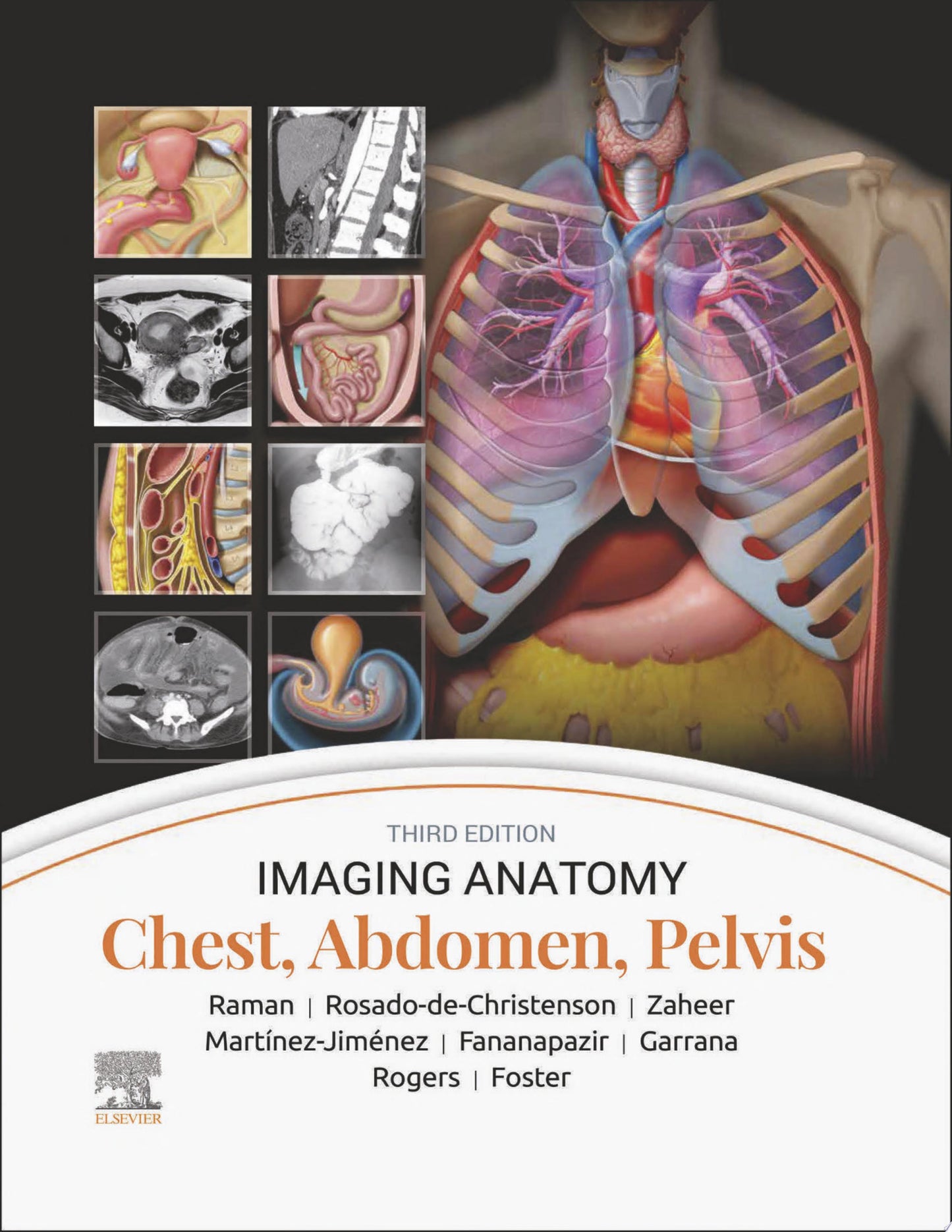 Imaging Anatomy: Chest, Abdomen, Pelvis, 2nd Edition