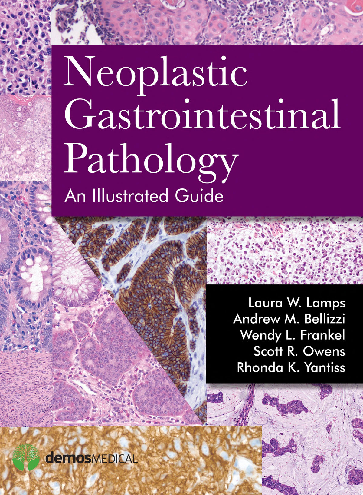 Neoplastic Gastrointestinal Pathology: An Illustrated Guide