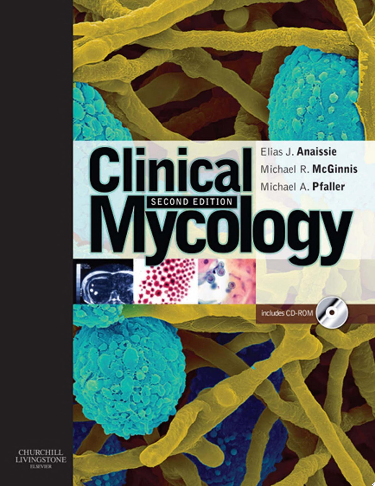 Clinical Mycology, 2nd Edition