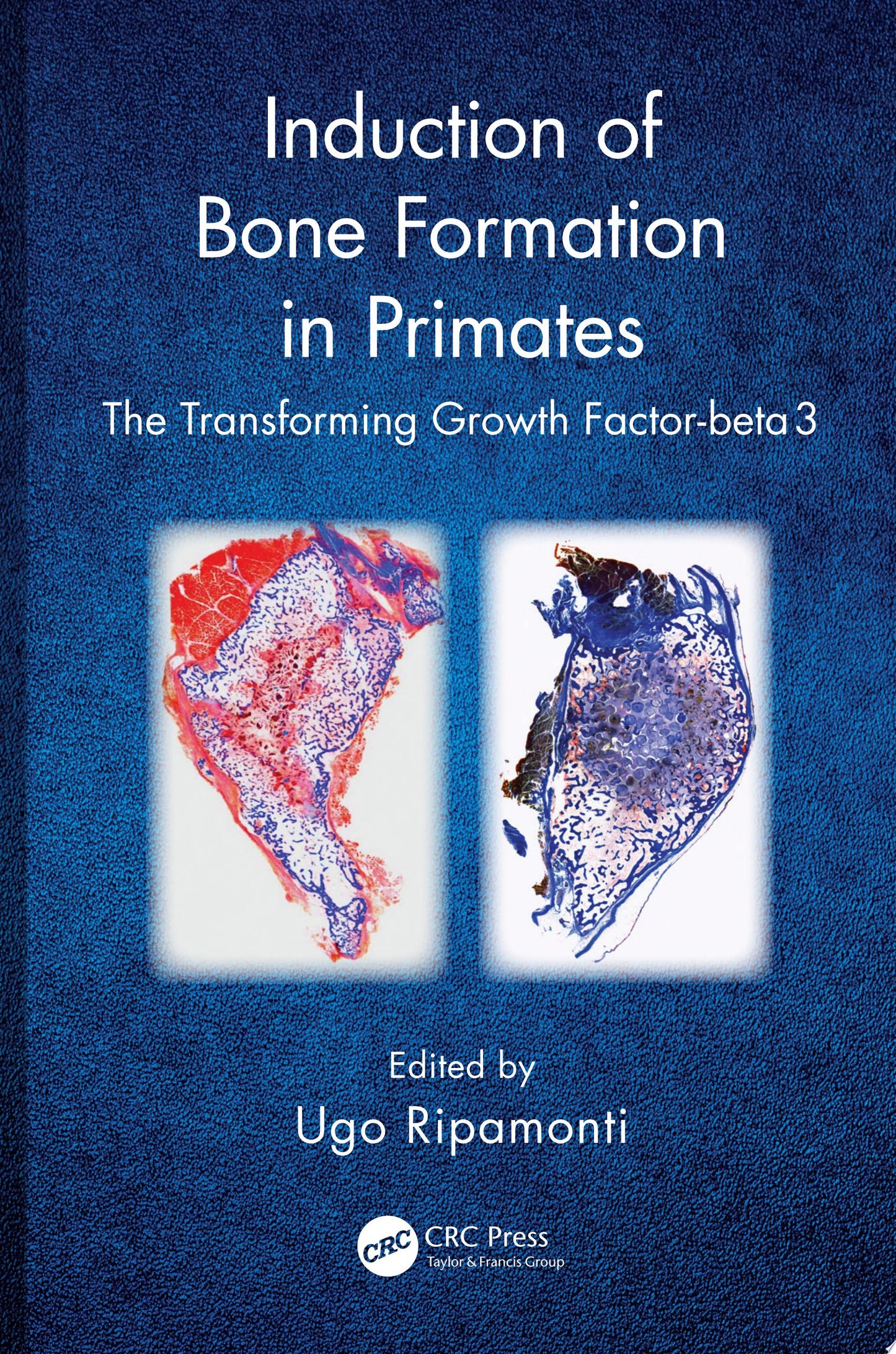 Induction of Bone Formation in Primates: The Transforming Growth Factor-Beta 3