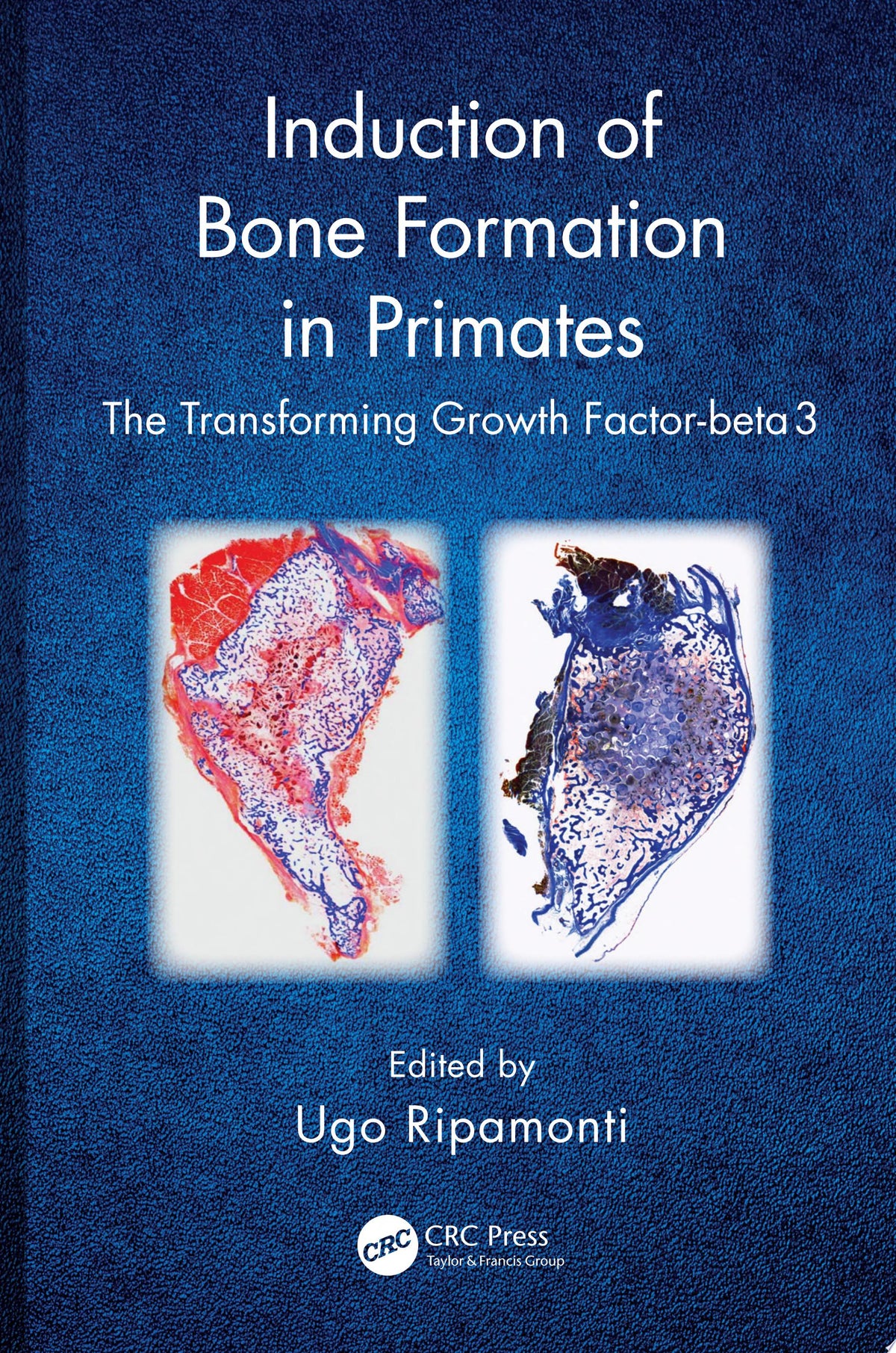 Induction of Bone Formation in Primates: The Transforming Growth Factor-Beta 3