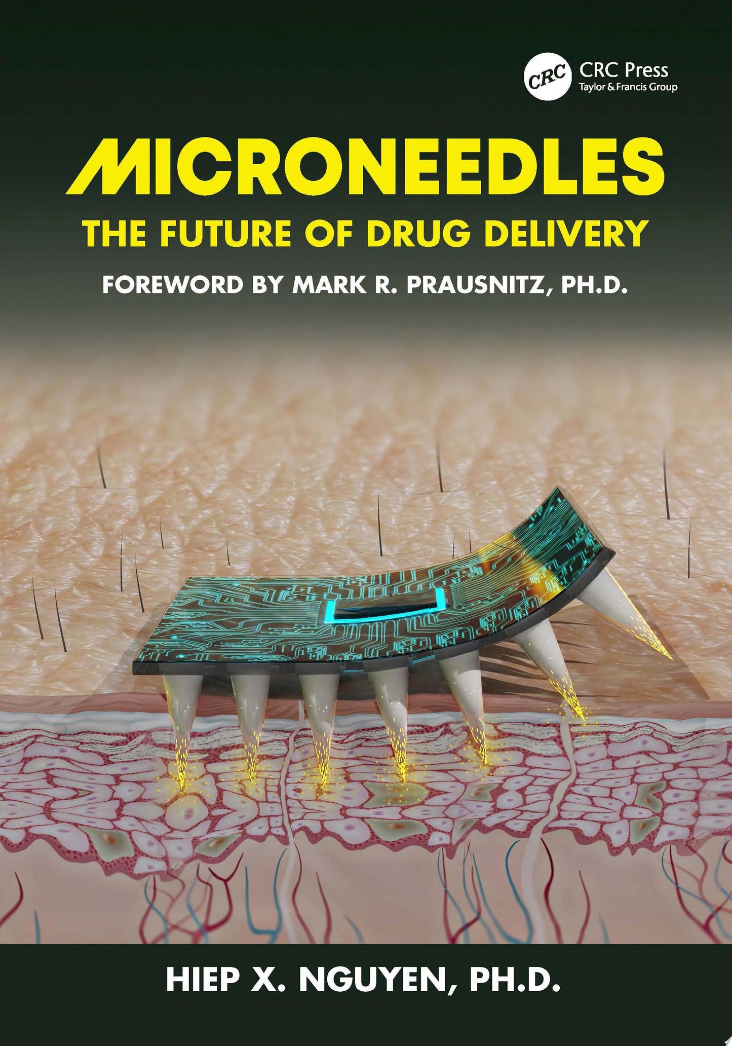 Microneedles