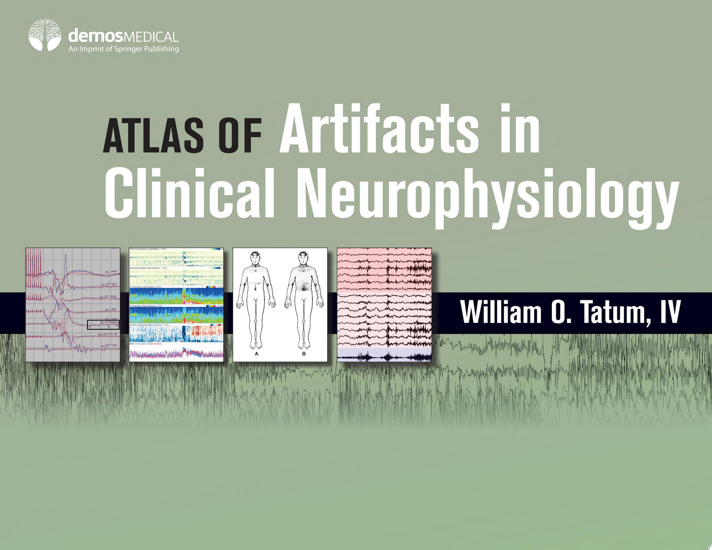 Atlas of Artifacts in Clinical Neurophysiology