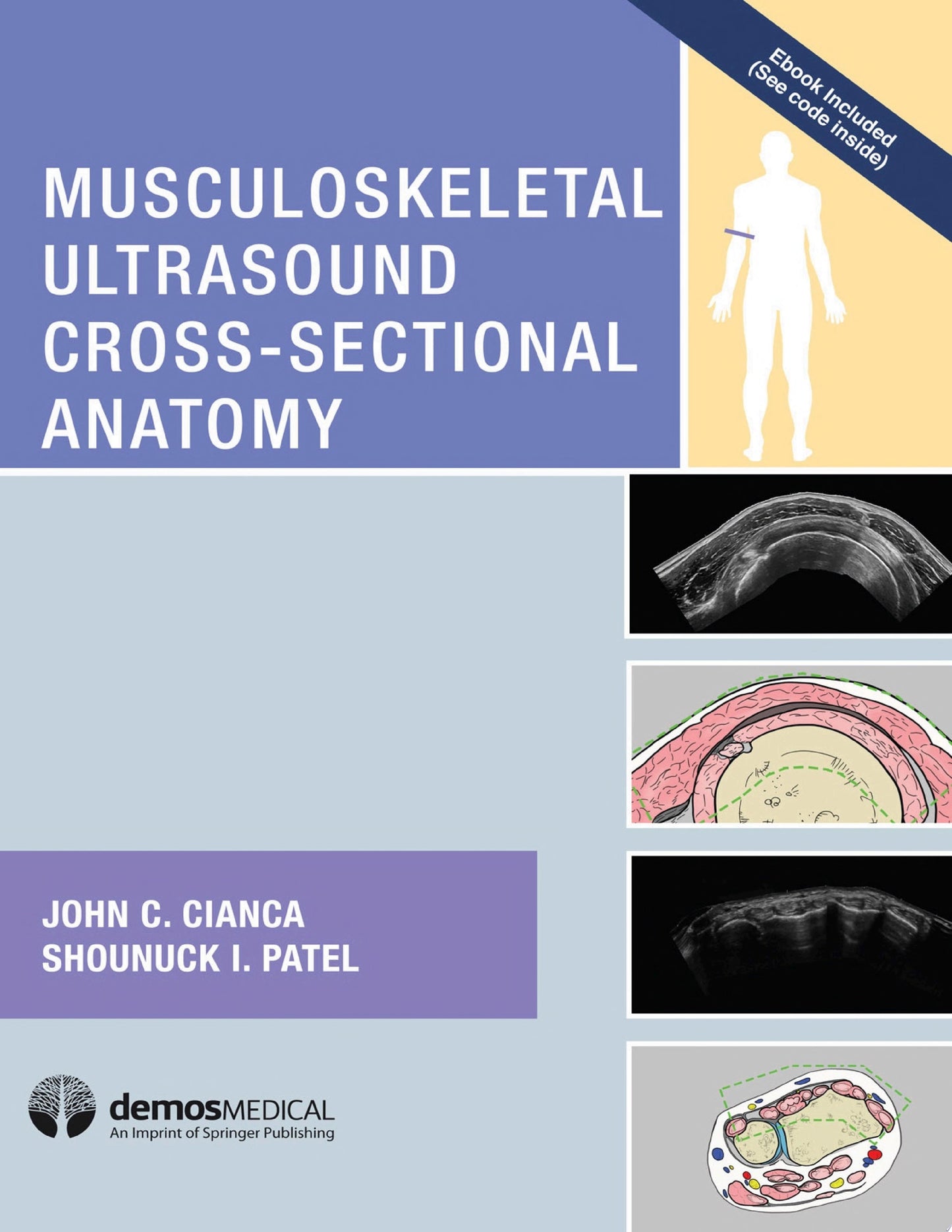 Musculoskeletal Ultrasound Cross-Sectional Anatomy