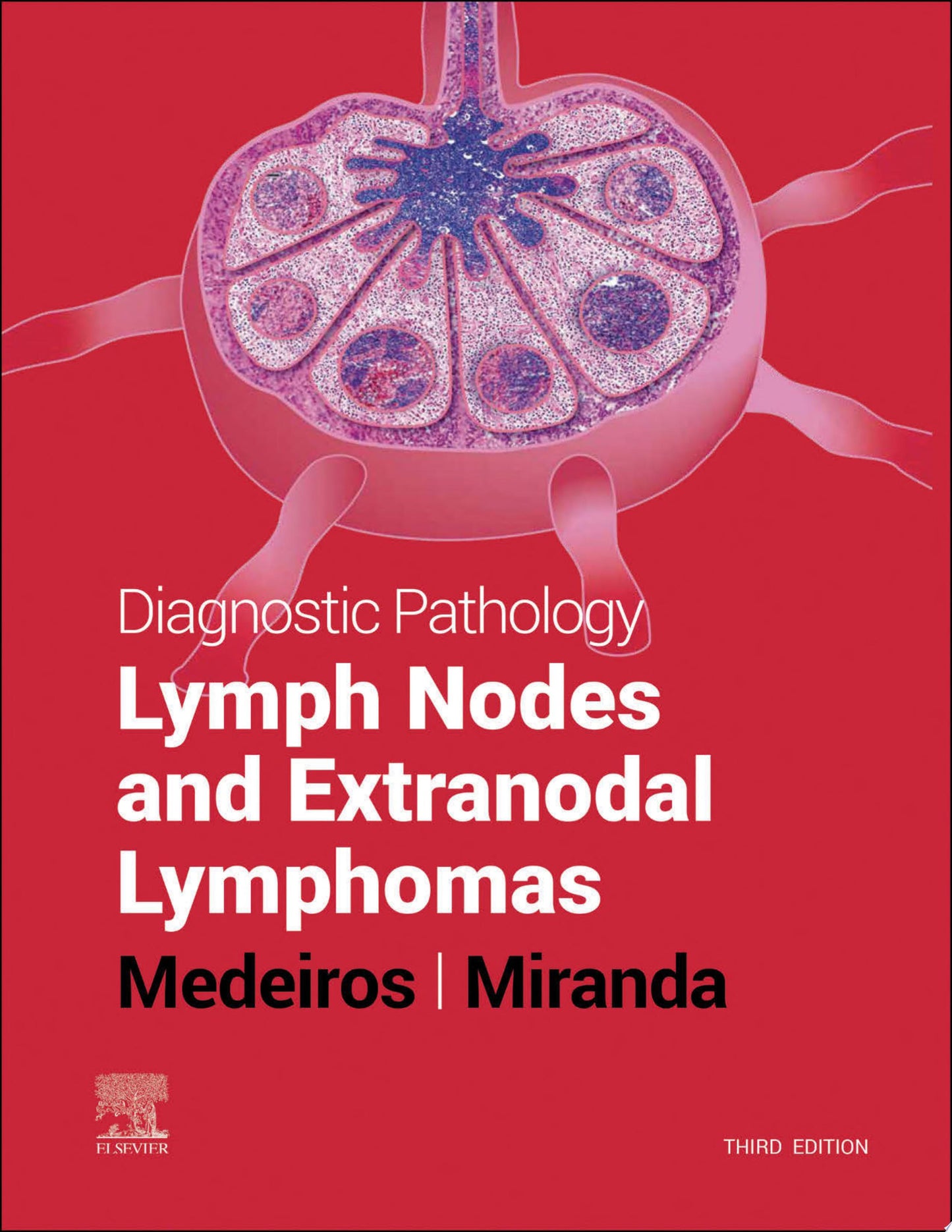 Diagnostic Pathology: Lymph Nodes and Extranodal Lymphomas, 2nd Edition