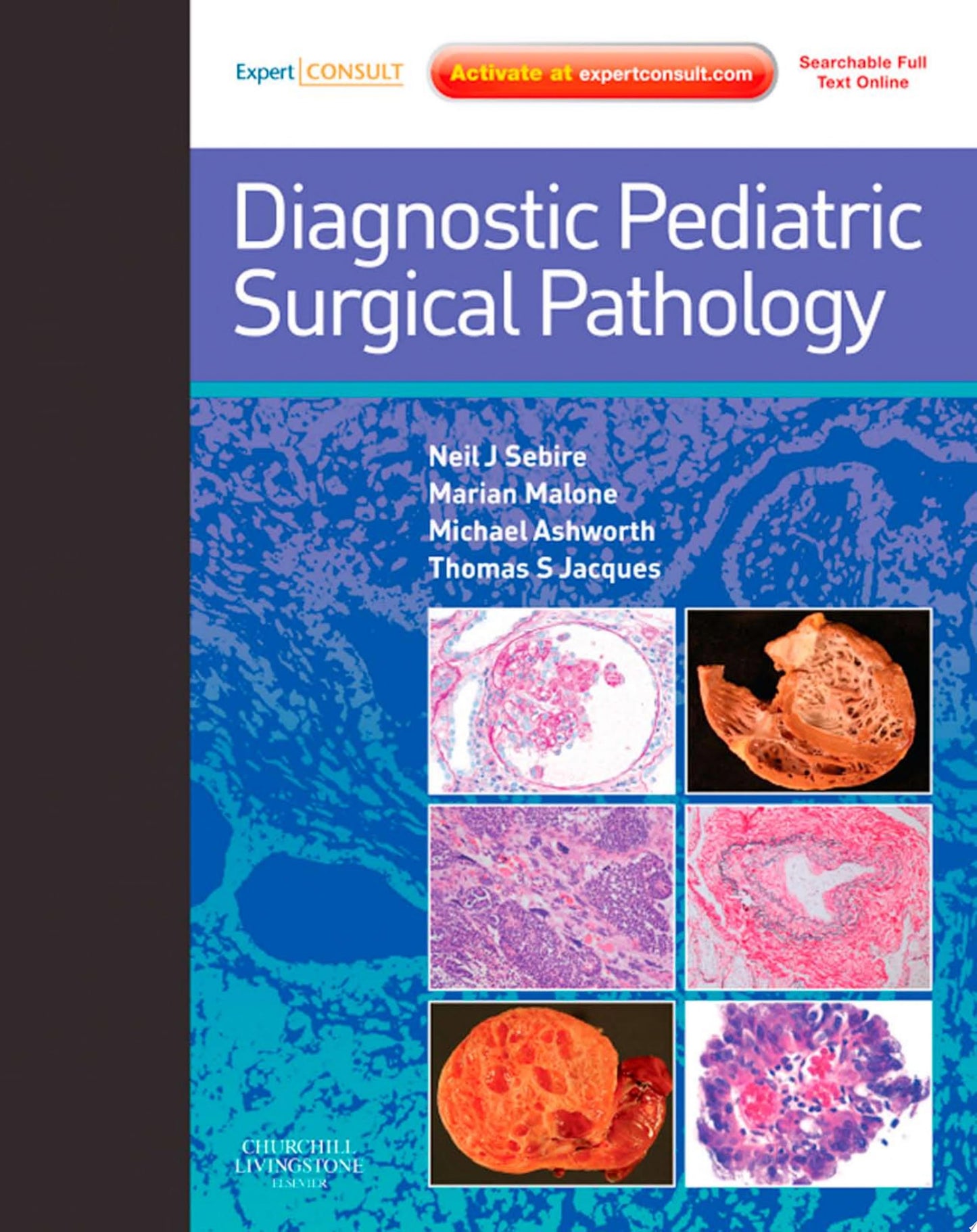 Atlas of Liver Pathology: Expert Consult – Online and Print, 3rd
