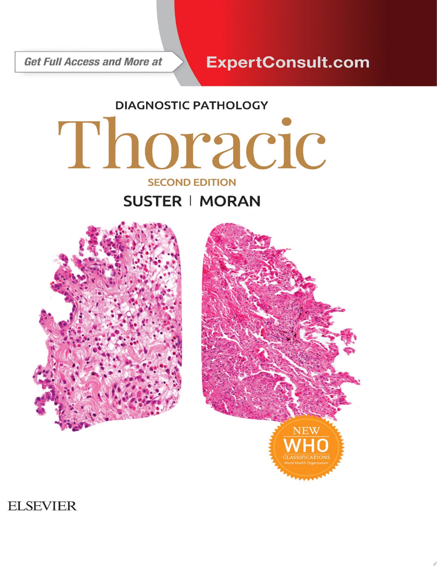 Diagnostic Pathology: Thoracic, 3rd edition