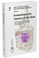 Nonmelanocytic Tumors of the Skin