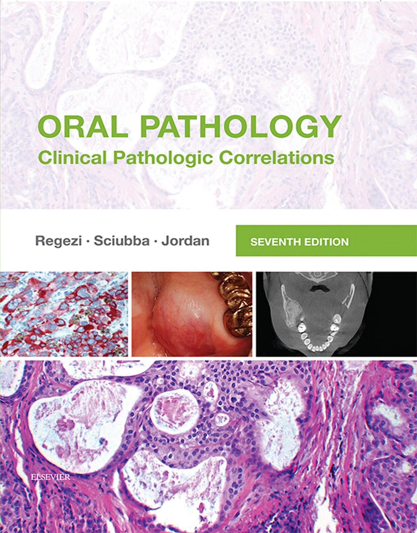 Oral Pathology: Clinical Pathologic Correlations, 6th Edition
