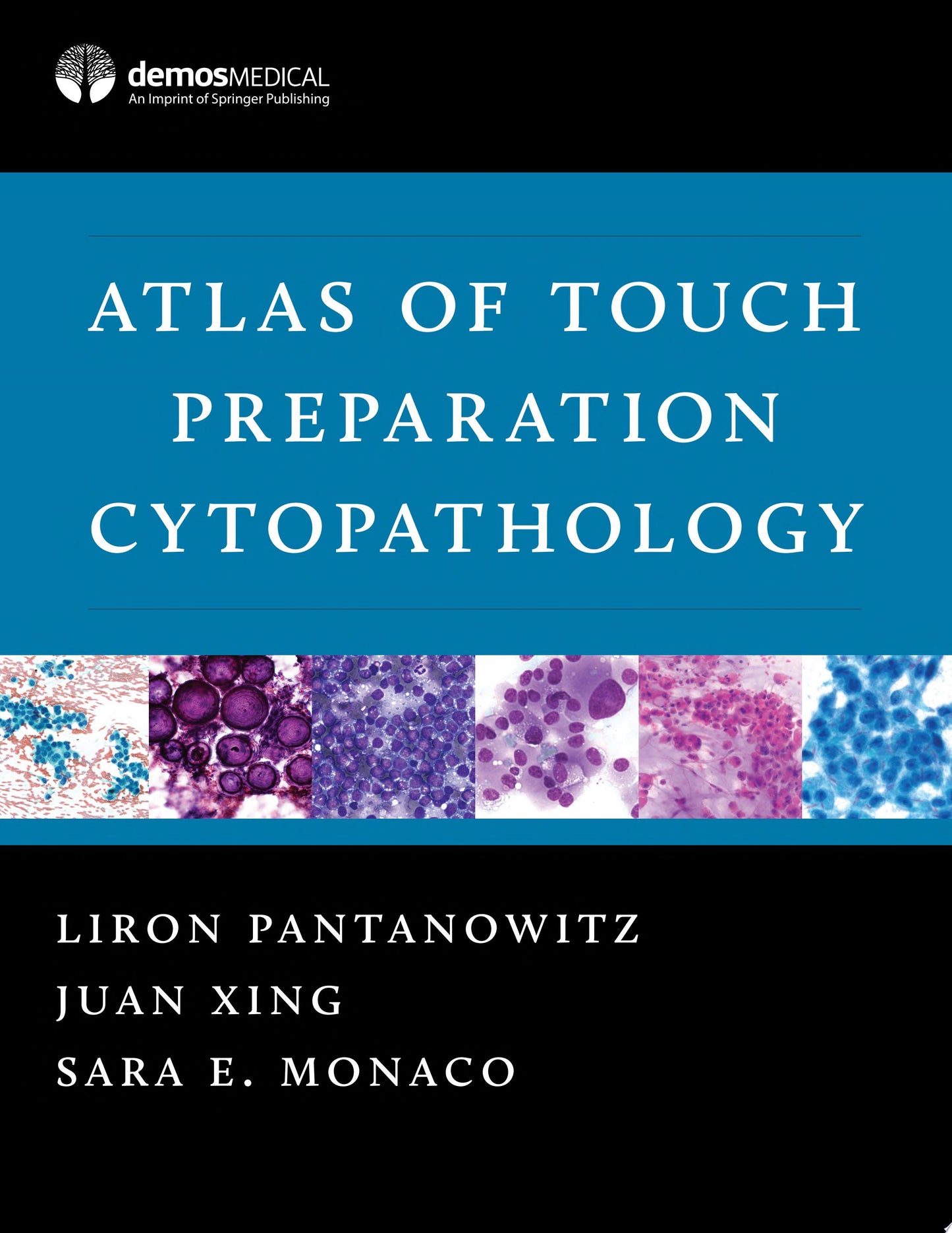 Atlas of Touch Preparation Cytopathology