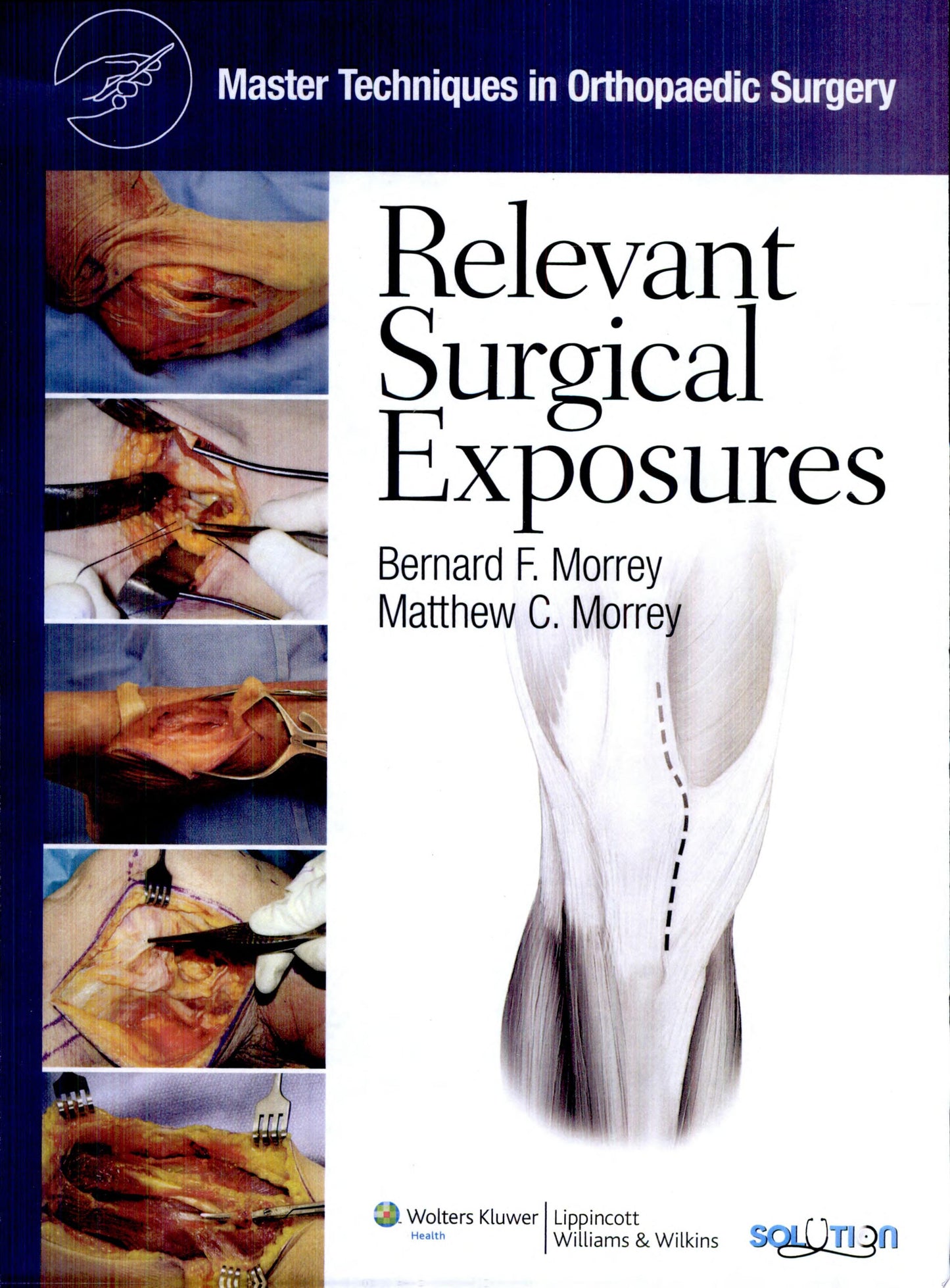 Surgical Exposures in Orthopaedics: The Anatomic Approach, 4th Edition
