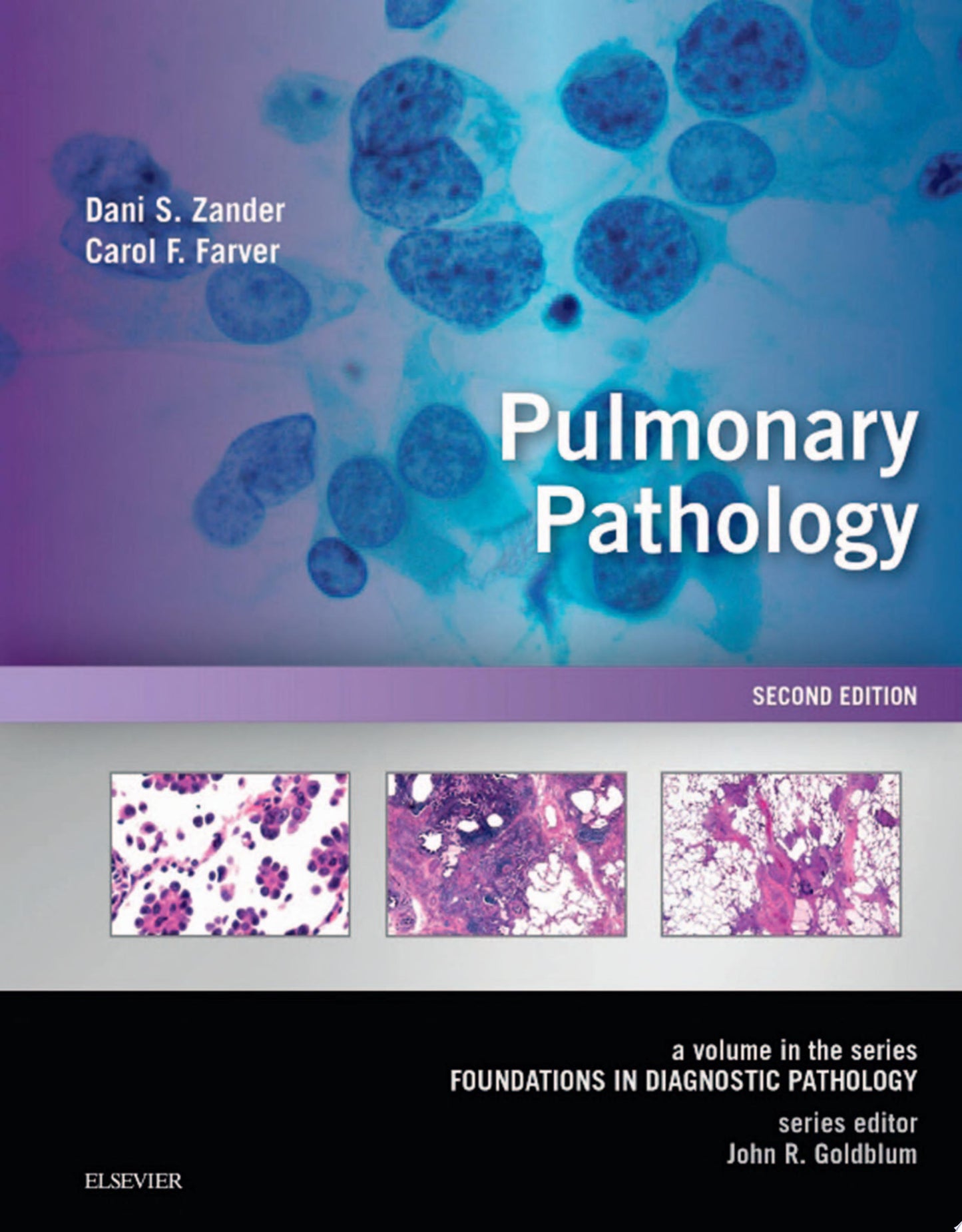 Pulmonary Pathology: A Volume in the Series: Foundations in Diagnostic Pathology, 2nd Edition