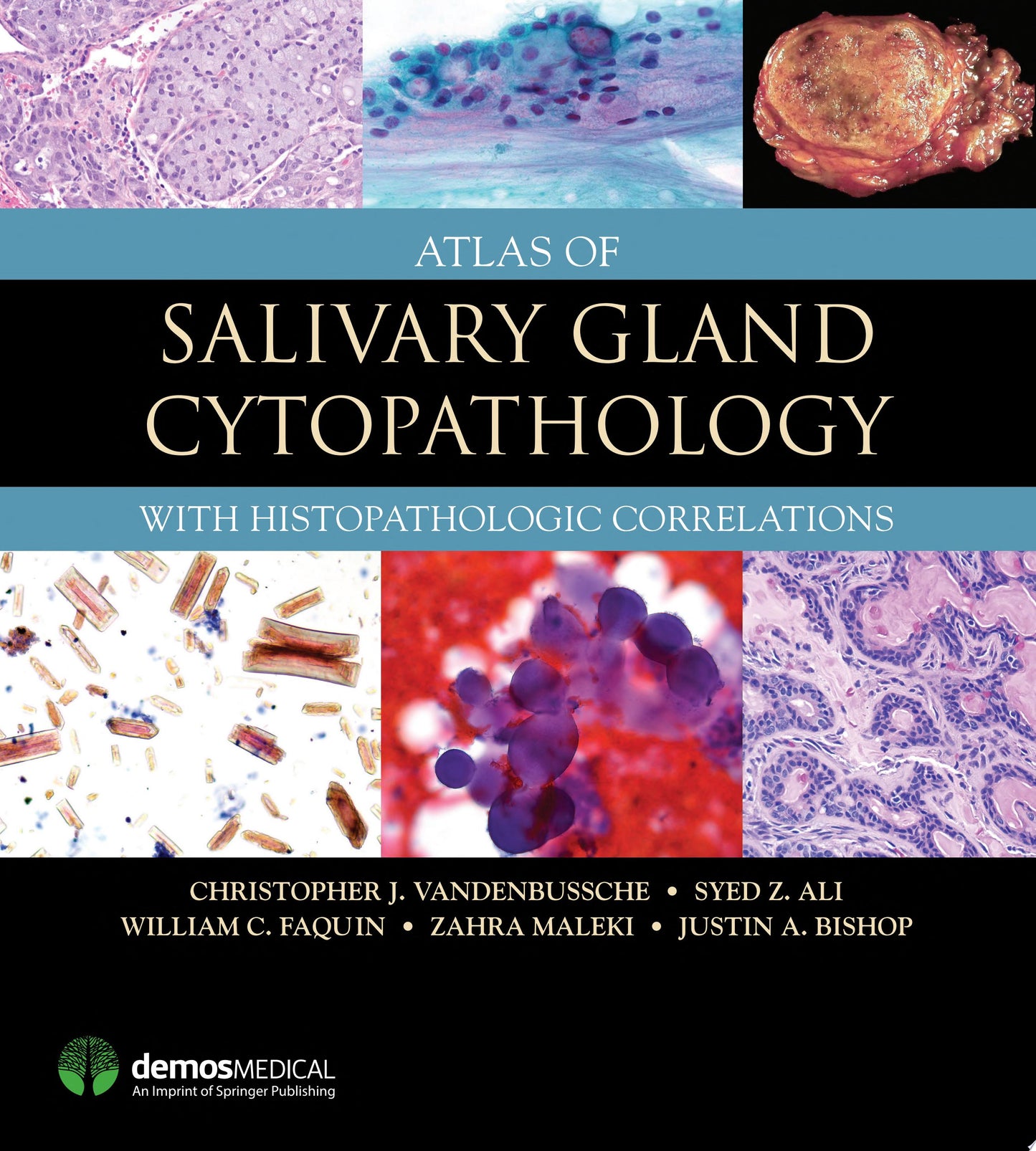 Atlas of Salivary Gland Cytopathology: with Histopathologic Correlations