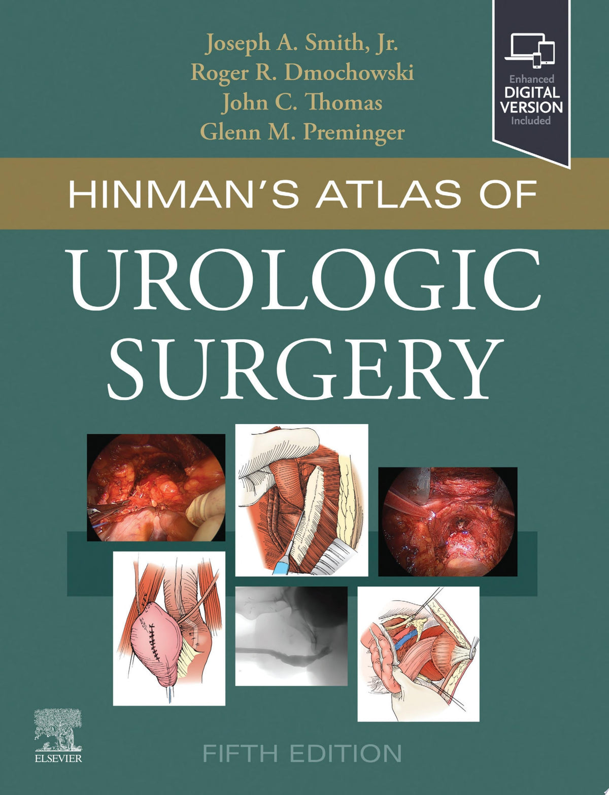 Hinman’s Atlas of Urologic Surgery, 5th Edition