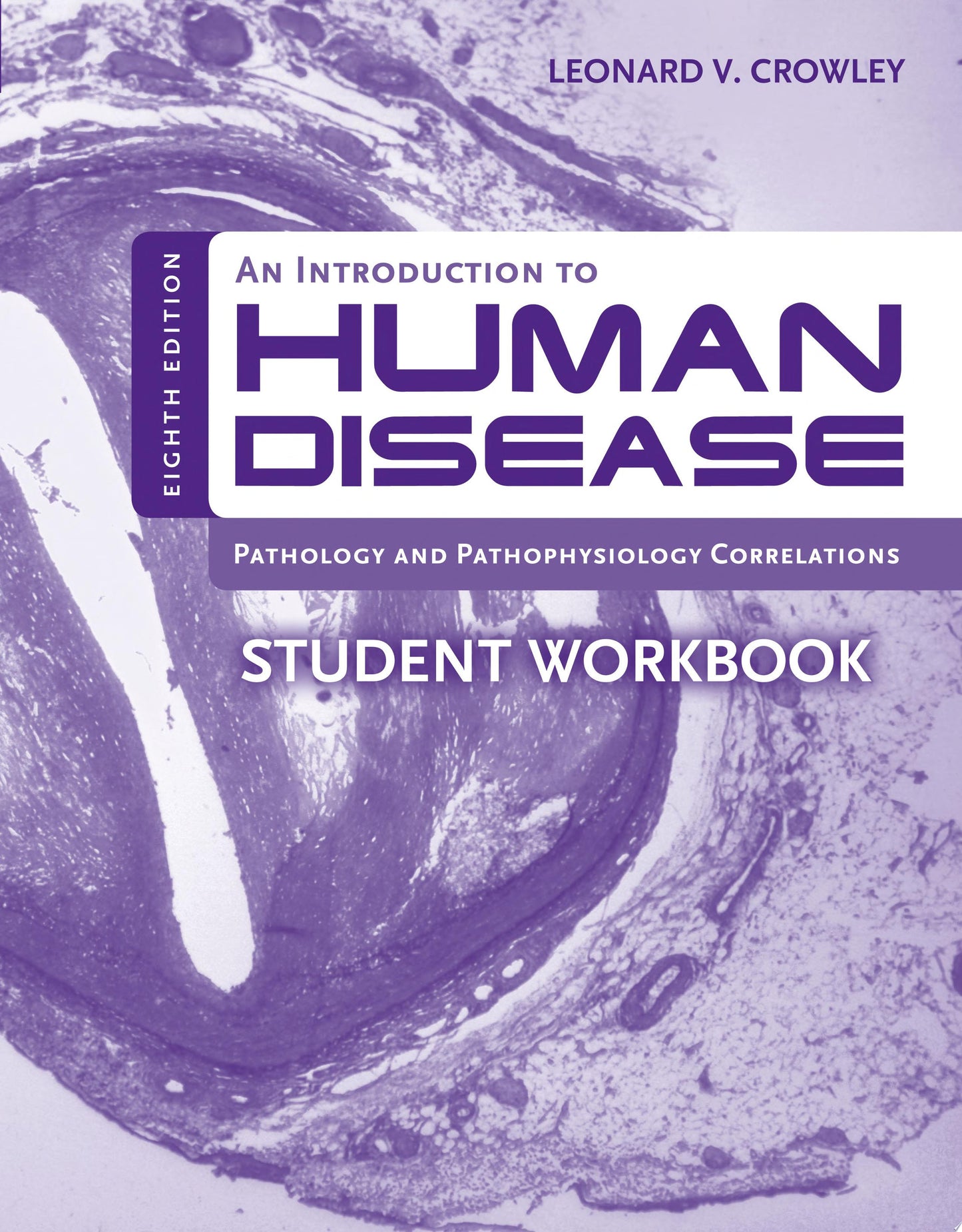 An Introduction To Human Disease: Pathology And Pathophysiology Correlations, 9th Edition