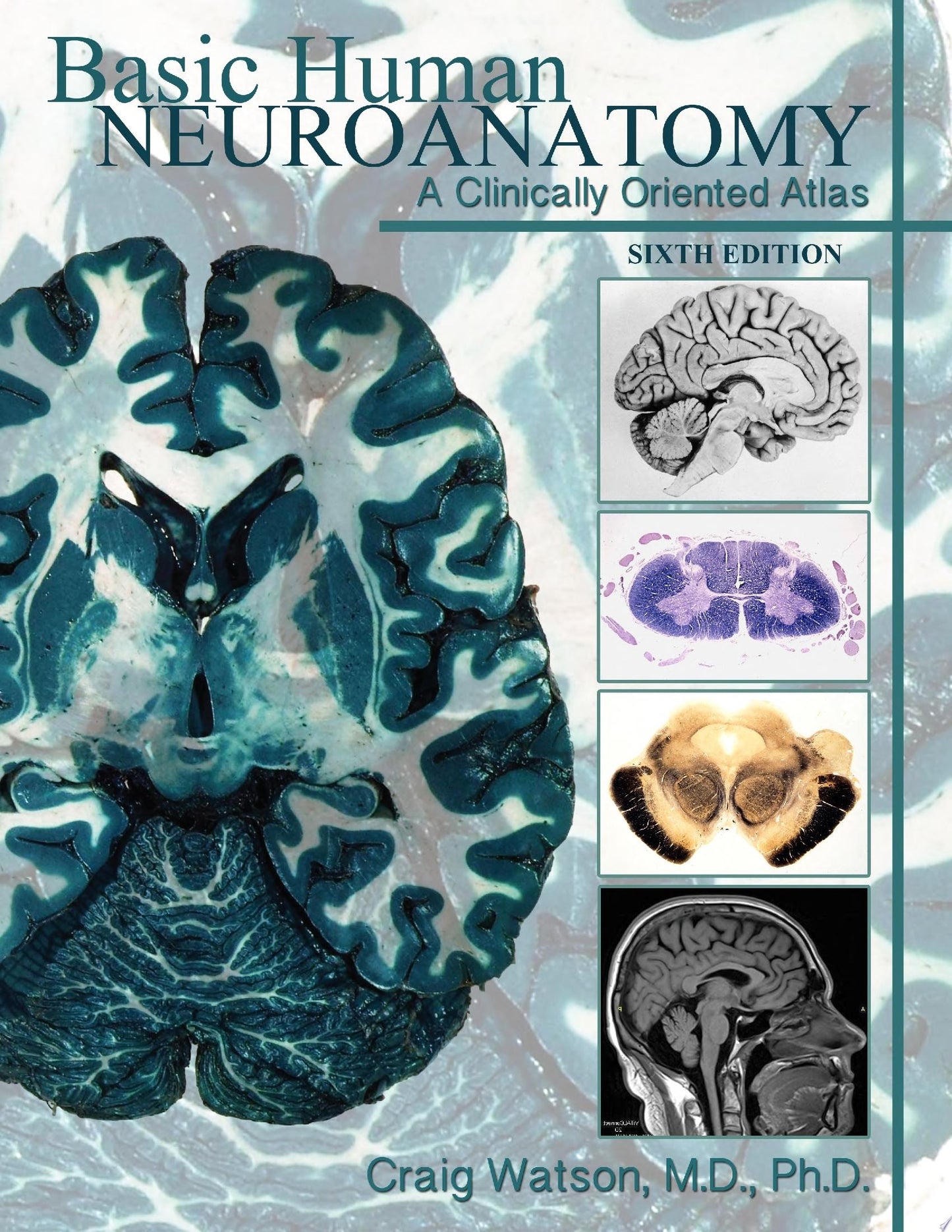 Neuroanatomy Through Clinical Cases, Second Edition