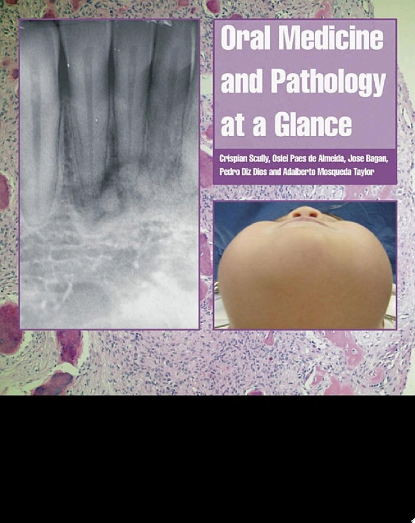 Oral Medicine and Pathology at a Glance, 2nd Edition