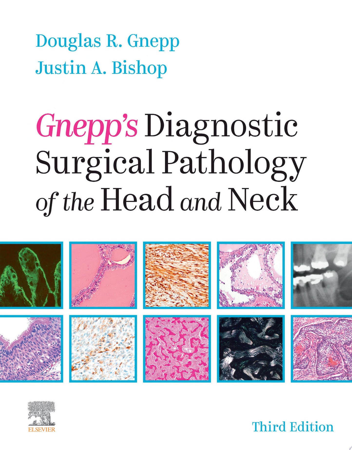Gnepp’s Diagnostic Surgical Pathology of the Head and Neck, 3ed )