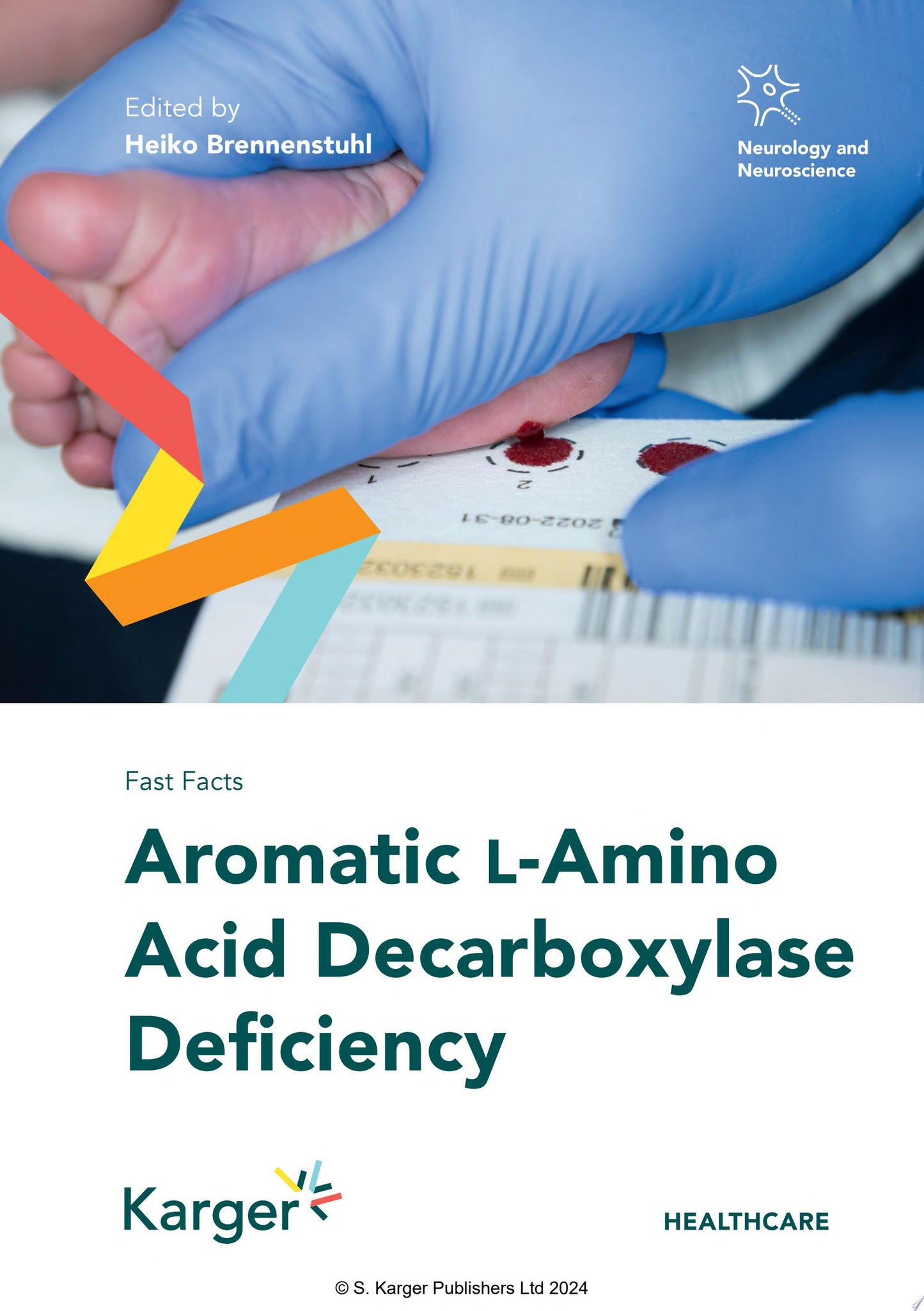 Fast Facts: Aromatic L-Amino Decarboxylase Deficiency