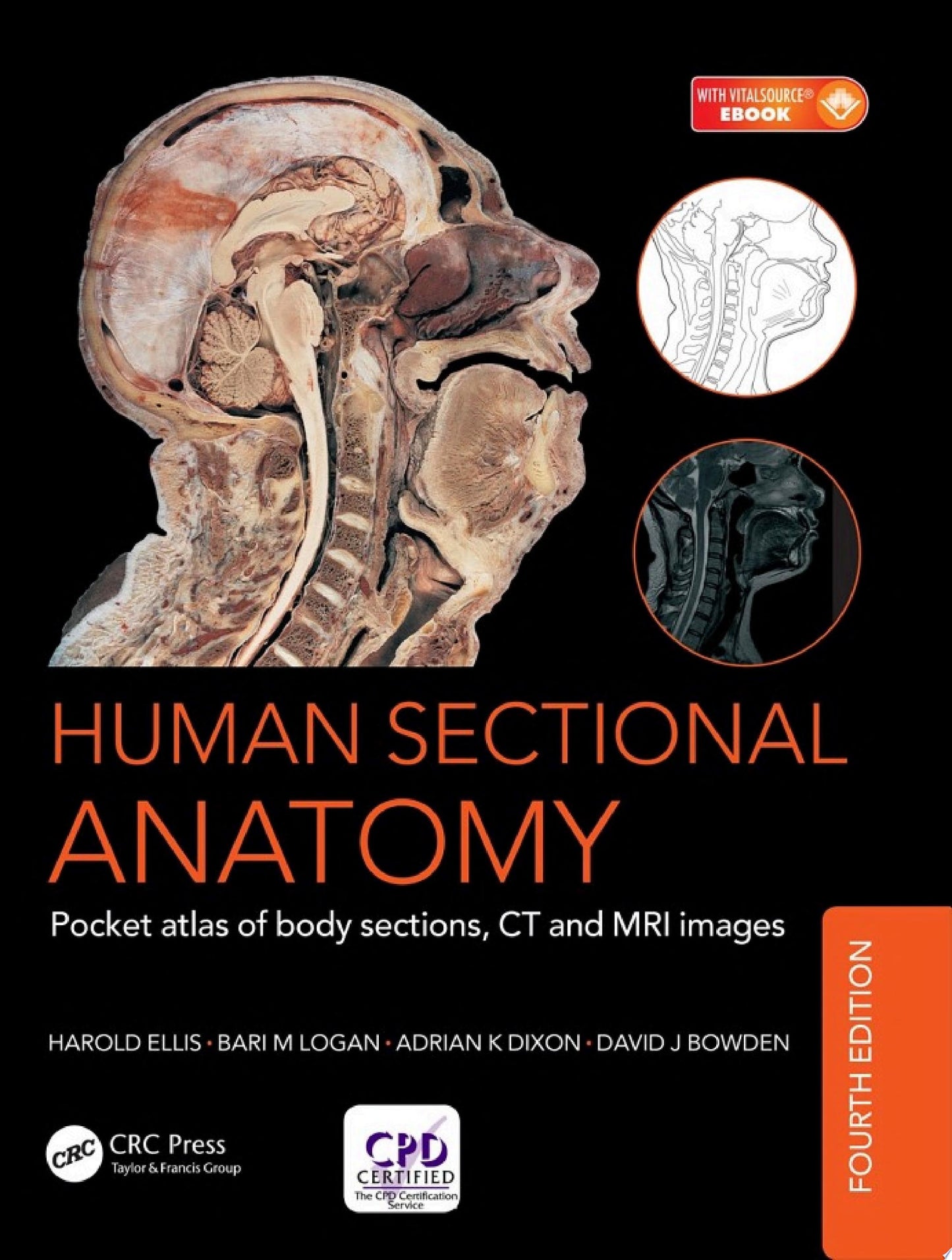 Human Sectional Anatomy: Atlas of Body Sections, CT and MRI Images, Fourth Edition
