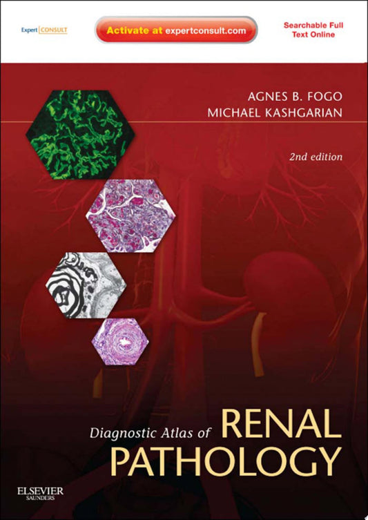 Diagnostic Atlas of Renal Pathology: Expert Consult – Online and Print, 2nd Edition