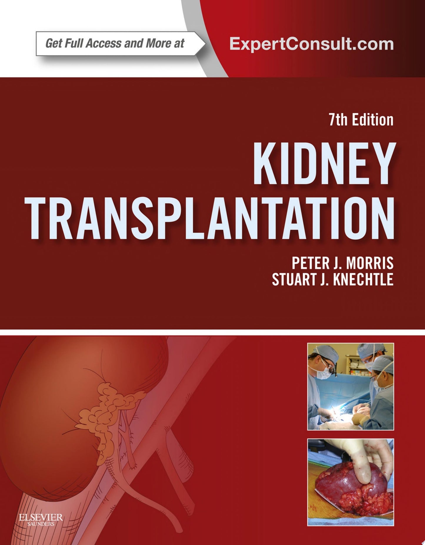 Transplantation Pathology, 2nd Edition