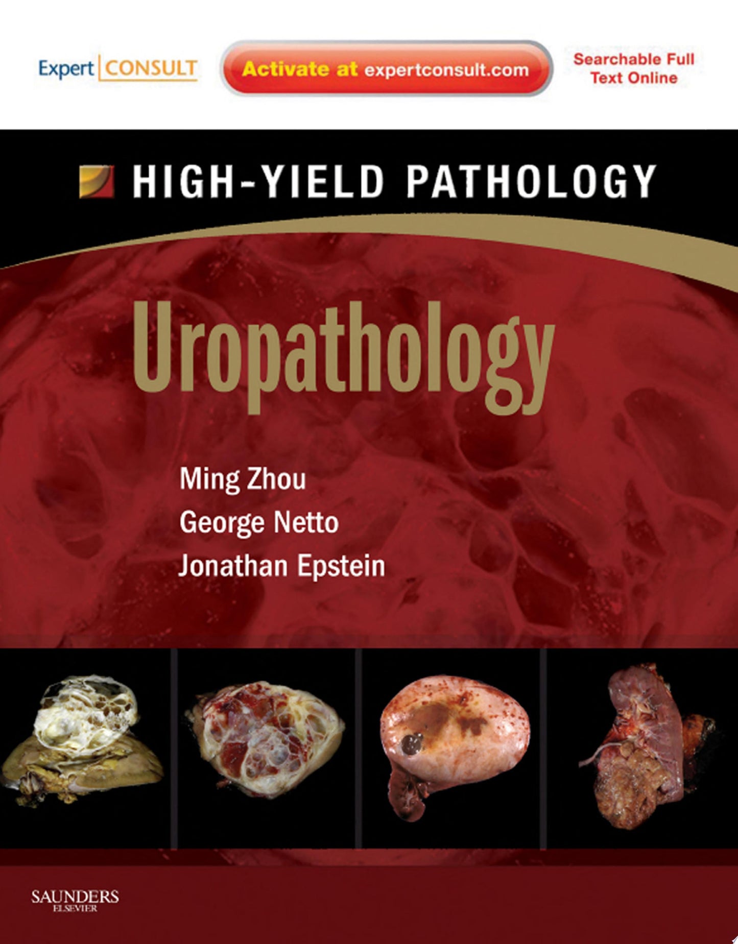 Uropathology: A Volume in the High Yield Pathology Series