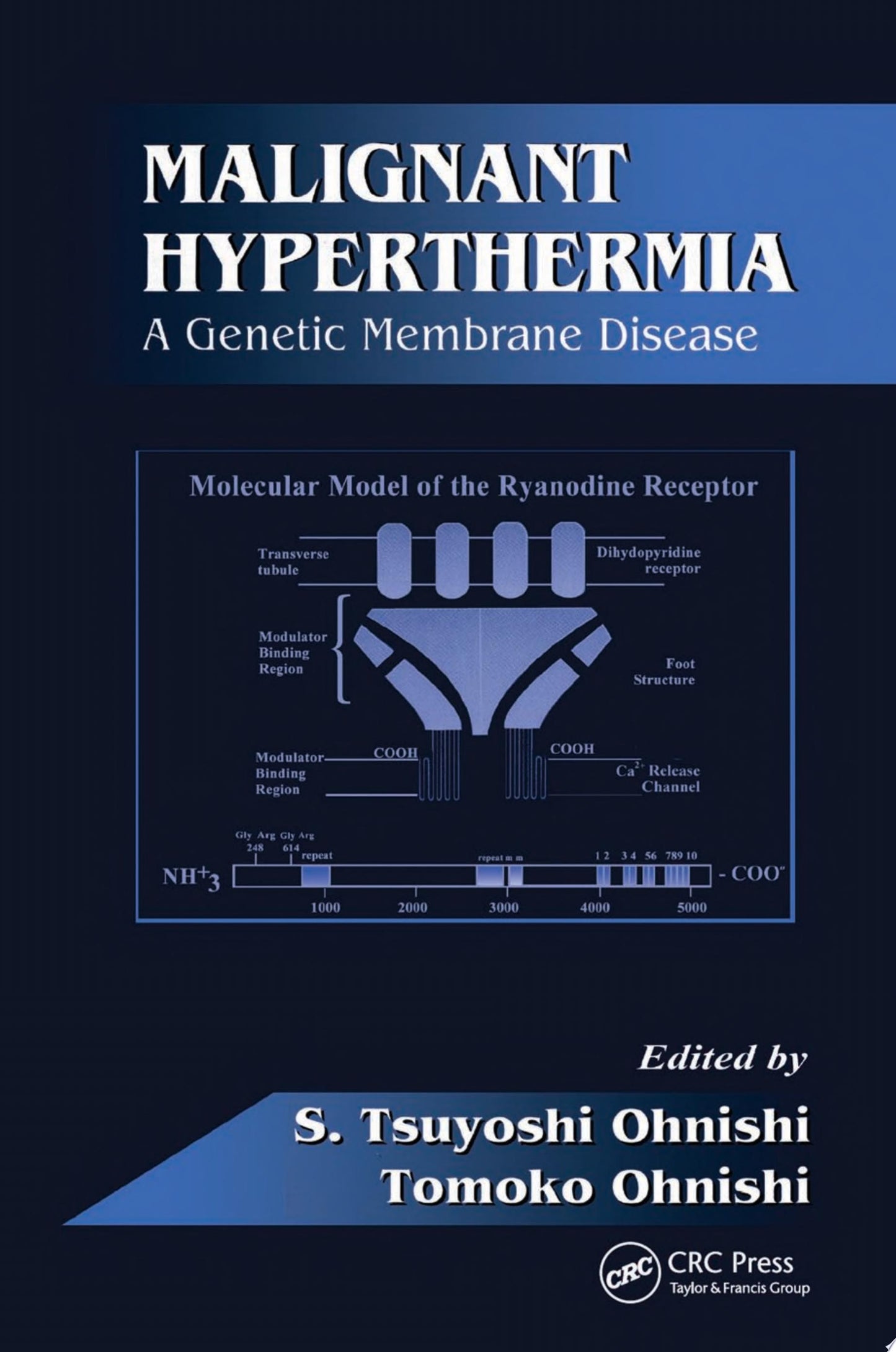 Malignant Hyperthermia: A Genetic Membrane Disease