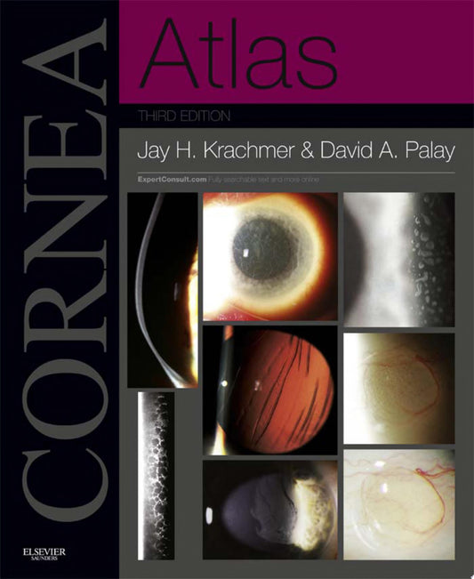 Atlas of Cornea