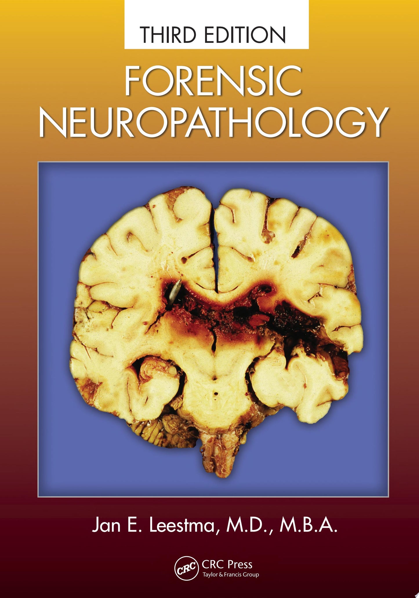 Forensic Neuropathology, Third Edition