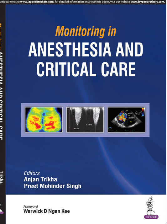 Monitoring in Anesthesia and Critical Care