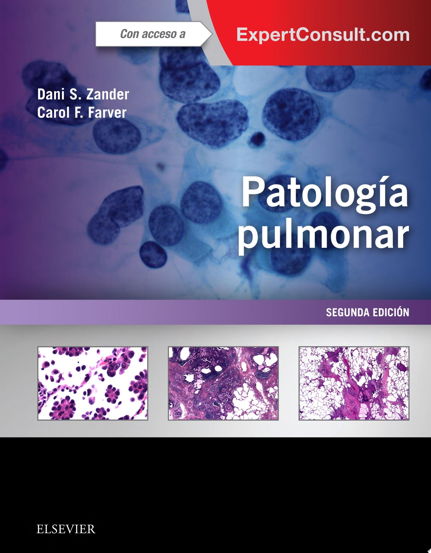 Patología pulmonar + ExpertConsult