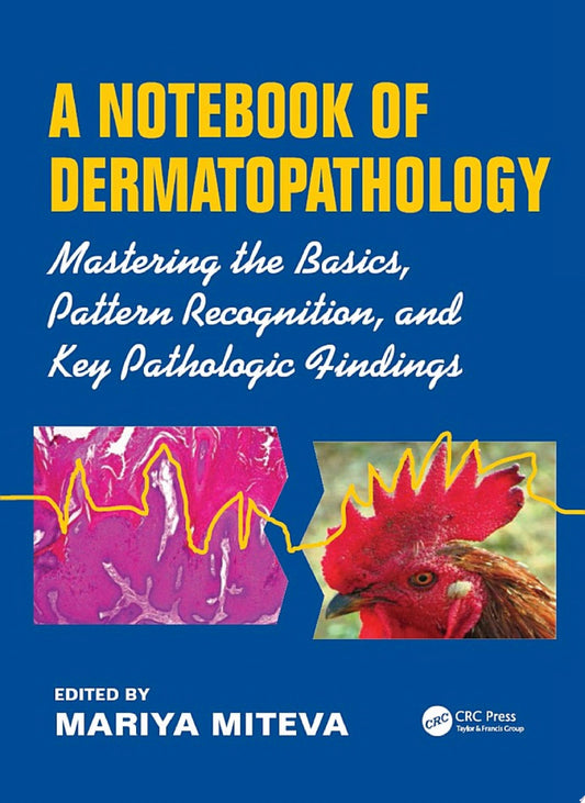 A Notebook of Dermatopathology: Mastering the Basics, Pattern recognition, and Key Pathologic Findings