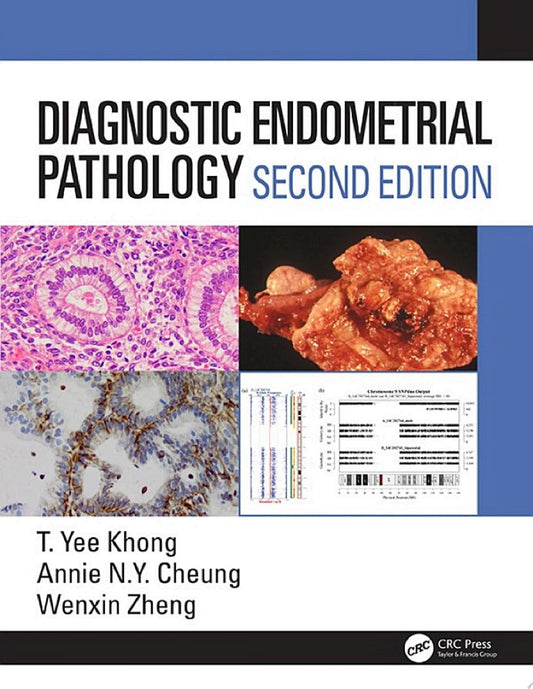 Diagnostic Endometrial Pathology, 2nd Edition