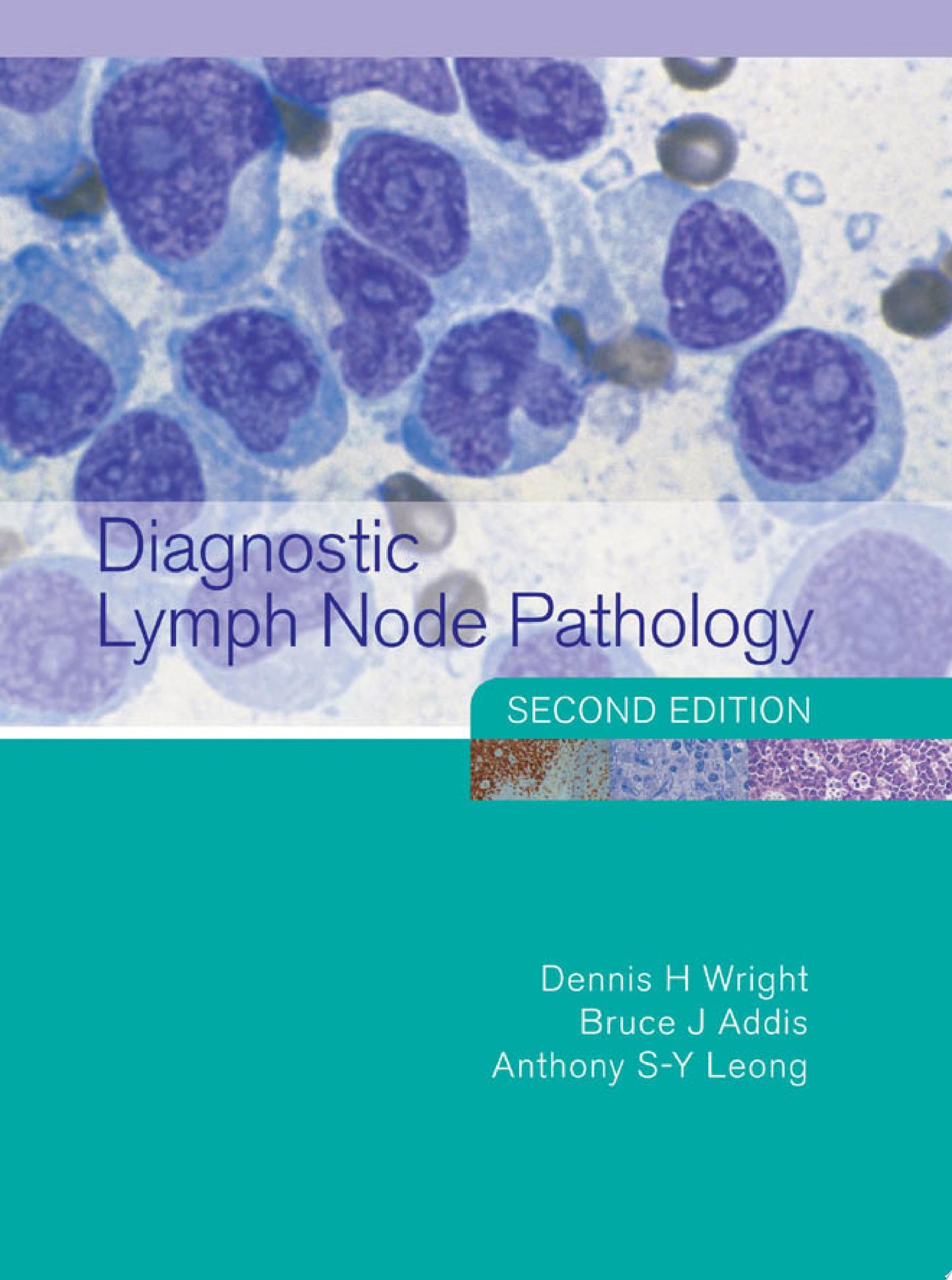 Diagnostic Lymph Node Pathology