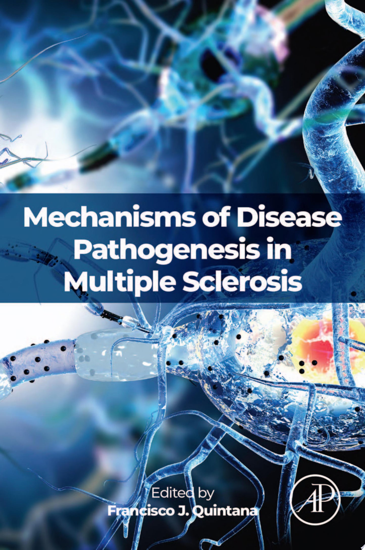 Mechanisms of Disease Pathogenesis in Multiple Sclerosis